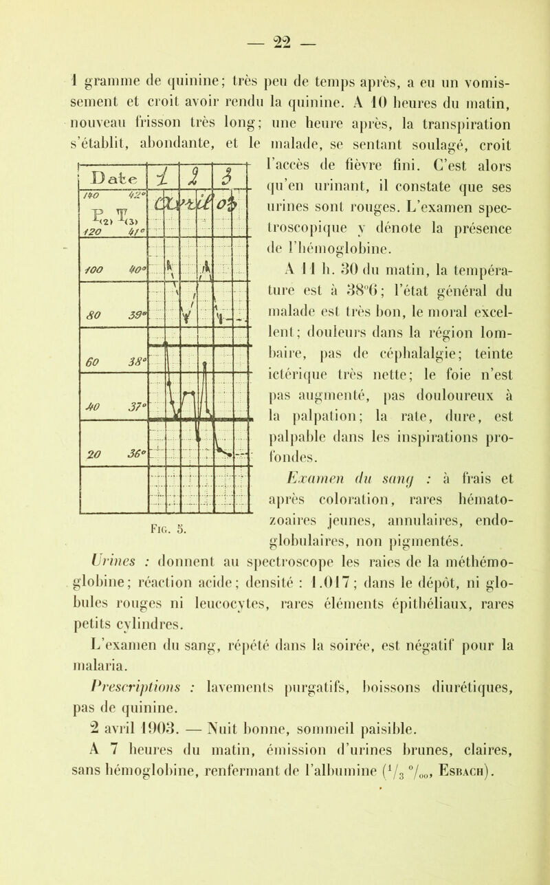 1 gramme de quinine; très peu de temps après, a eu un vomis- sement et croit avoir rendu la quinine. A 10 heures du matin, nouveau frisson très long; une heure après, la transpiration s’établit, abondante, et le malade, se sentant soulagé, croit l’accès de fièvre fini. C’est alors qu’en urinant, il constate que ses urines sont rouges. L’examen spec- troscopique y dénote la présence de T hémoglobine. À 11 h. 30 du matin, la tempéra- ture est à 38°6; l’état général du malade est très bon, le moral excel- lent; douleurs dans la région lom- baire, pas de céphalalgie; teinte ictérique très nette; le foie n’est pas augmenté, pas douloureux à la palpation; la rate, dure, est palpable dans les inspirations pro- fondes. Examen du sang : à frais et après coloration, rares hémato- zoaires jeunes, annulaires, endo- globulaires, non pigmentés. Urines : donnent au spectroscope les raies de la méthémo- globine; réaction acide; densité : 1.017 ; dans le dépôt, ni glo- bules rouges ni leucocytes, rares éléments épithéliaux, rares petits cylindres. L’examen du sang, répété dans la soirée, est négatif' pour la malaria. Prescriptions : lavements purgatifs, boissons diurétiques, pas de quinine. 2 avril 1903. — Nuit bonne, sommeil paisible. A 7 heures du matin, émission d’urines brunes, claires, sans hémoglobine, renfermant de l’albumine (1/s °/00, Esbach). D aire i J 3 fiK) 42° p> TT7 i2C tff° c Zi >-ti Ü lOO 40° fc V T. J j l 80 39e ”T V 9 r y Y- 60 38° JfO 37° ! Yr 20 36° 4- f P Fig. 5.