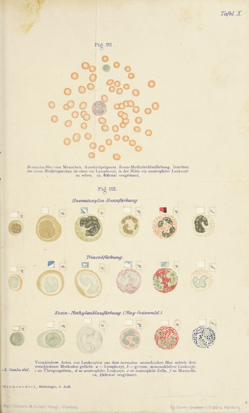 lü<5. 111. O O o Oo m° -o ° O 0n ® o o° °o°o <9 0 m a^°o ftO 0<0%s# ^ ° O O o GO o o o o pv o o~ oQ* °o o o o Normales Blut vom Menschen. Ausstrichpräparat. Eosin-Methylenblaufärbung. Inmitten der roten Blutkörperchen ist oben ein Lymphozyt, in der Mitte ein neutrophiler Leukozyt ,, zu sehen, ca. 600 mal vergrössert. I Eosvns-J^pJ?iyl#TvblauffobuJicr. (Mccy Oriuiwcdd). Verschiedene Arten von Leukozyten aus dem normalen menschlichen Blut mittels drei verschiedener Methoden gefärbt, a — Lymphozyt, b = grosser, mononukleärer Leukozyt, L. CscUcccfyel, c = Übergangsform, d = neutrophiler Leukozyt, e — eosinophile Zelle, f — Mastzelle. ca. 1000 mal vergrössert. Szymonowicz, Histologie, 2. Aufl. \mmm . hi . ■