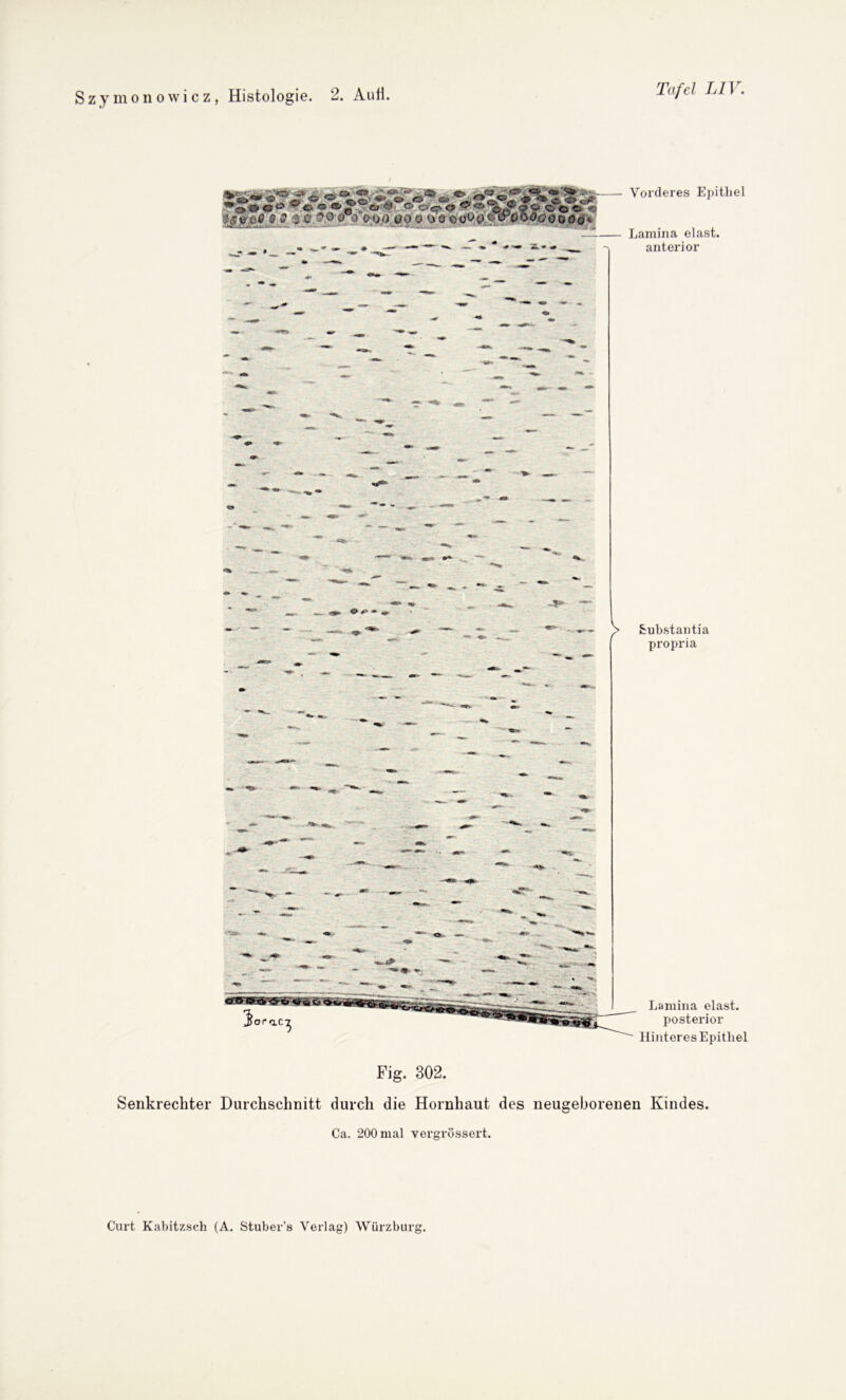 ws>®0° ® 6»'1 ° <=>«r. o «& yjyyjB# s SßQ &ß tro eoo öooo'o ooi>y ?&S38I ’OOOüOQOo* Vorderes Epithel Lamina elast. Fig. 302. Senkrechter Durchschnitt durch die Hornhaut des neugeborenen Kindes. Ca. 200 mal vergrössert.