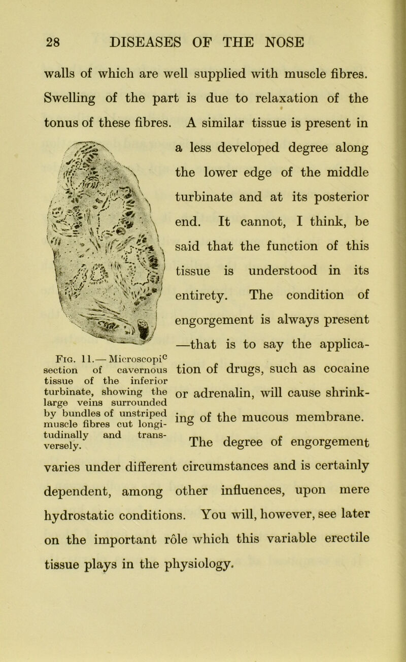 :s7 \ ihtf* \ walls of which are well supplied with muscle fibres. Swelling of the part is due to relaxation of the tonus of these fibres. A similar tissue is present in a less developed degree along the lower edge of the middle turbinate and at its posterior \ end. It cannot, I think, be \ said that the function of this l tissue is understood in its w - entirety. The condition of engorgement is always present —that is to say the applica- Fig. 11.— Microscopi^ section of cavernous tion of drugs, such as cocaine tissue of the inferior turbinate, showing the or adrenalin, will cause shrink- large veins surrounded by bundles of unstriped ; mucous membrane, muscle fibres cut longi- o tudinally and trans- mi i r versely. The degree of engorgement varies under different circumstances and is certainly dependent, among other influences, upon mere hydrostatic conditions. You will, however, see later on the important role which this variable erectile tissue plays in the physiology.