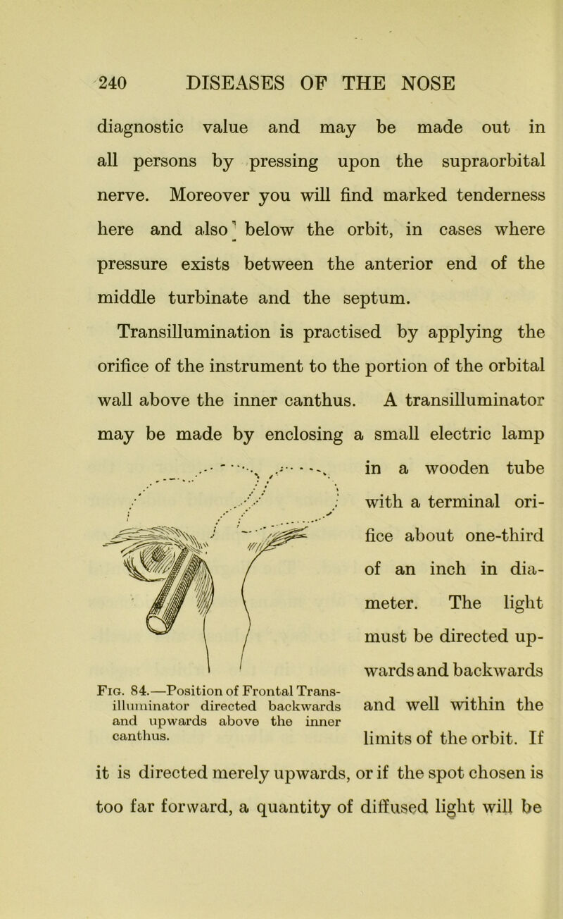 diagnostic value and may be made out in all persons by pressing upon the supraorbital nerve. Moreover you will find marked tenderness here and also below the orbit, in cases where pressure exists between the anterior end of the middle turbinate and the septum. Transillumination is practised by applying the orifice of the instrument to the portion of the orbital wall above the inner canthus. A transilluminator may be made by enclosing a small electric lamp in a wooden tube with a terminal ori- fice about one-third of an inch in dia- meter. The light must be directed up- wards and backwards and well 'svithin the limits of the orbit. If it is directed merely upwards, or if the spot chosen is too far forward, a quantity of diffused light will be Fig. 84.—Position of Frontal Trans- illuniinator directed backwards and upwards above the inner canthus.