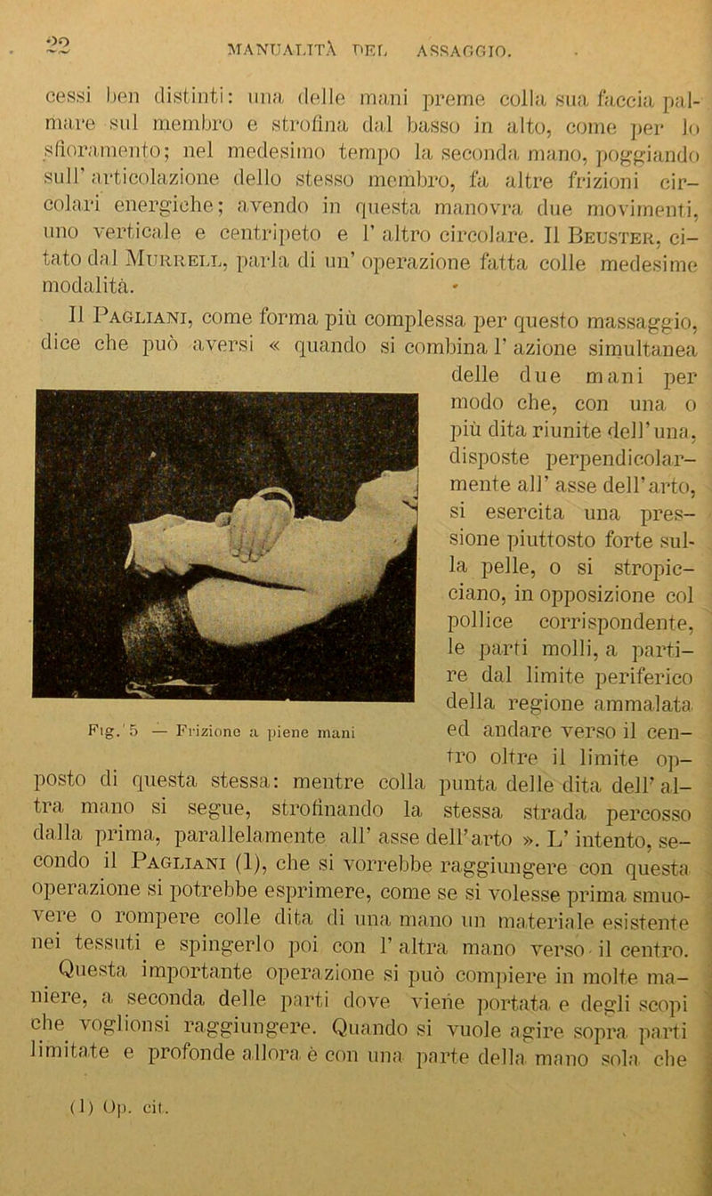 cessi ben distinti: nn;i, delle mani preme colla sua fiiccia pal- mare sul membro e strofina dal basso in alto, come ])er lo slìoramento; nel medesimo tempo la seconda, mano, poggiando sull’ articolazione dello stesso membro, fa altre frizioni cir- colari energiche; avendo in questa manovra due movimenti, imo verticale e centripeto e 1’ altro circolare. Il Beuster, ci- tato dal Murrell, parla di un’ operazione fatta colle medesime modalità. Il Pagliani, come forma più complessa per questo massaggio, dice che può aversi « quando si combina T azione simultanea delle due mani per modo che, con una o più dita riunite dell’una, disposte perpendicolar- mente air asse dell’arto, si esercita una pres- sione piuttosto forte sul- la pelle, 0 si stropic- ciano, in opposizione col pollice corrispondente, le parti molli, a parti- re dal limite periferico della regione ammalata ed andare verso il cen- tro oltre il limite op- posto di questa stessa: mentre colla punta delle dita dell’al- tra mano si segue, strofinando la stessa strada percosso dalla prima, parallelamente all’ asse dell’arto ». L’intento, se- condo il Pagliani (1), che si vorrebbe raggiungere con questa operazione si potrebbe esprimere, come se si volesse prima smuo- vere 0 rompere colle dita di una mano un ma.teriale esistente nei tessuti e spingerlo poi con l’altra mano verso-il centro. Questa importante operazione si può com])iere in molte ma- niere, a, seconda delle parti dove viene portata, e degli scopi che voglionsi raggiungere. Quando si vuole agire sopra, parti \ limitate e profonde allora è con una parte della mano sola die 5