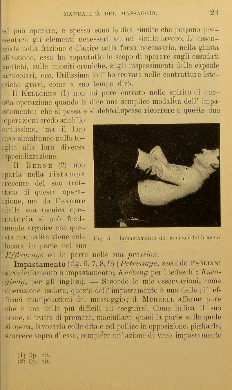 ^rAM.'AT-l^À nET; massaggio. 90 > 'SÌ può operare, e spesso sono le dita riunite che possono pre- 'sentare gli elementi necessari ad un simile lavoro. L’ essen- ziale nella frizione è d’agire colia forza necessaria, nella giusta direzione, essa ha sopratutto lo scopo di operare sugli essudati antichi, sulle miositi croniche, sugli inspessimenti delle capsule .articolari, ecc. Utilissima io V ho trovata nelle contratture iste- riche gravi, come a suo tempo dirò. Il Kellgren (1) non mi pare entrato nello spirito di que- ;sta operazione quando la dice una semplice modalità dell’ impa- <stamento; che si possa e si debba.'spesso ricorrere a queste due (Operazioni credo anch’io nitilissimo, ma il loro ; uso simultaneo nulla to- .glie alla loro diversa specializzazione. Il Berne (2) non ■parla nella ristampa recente del suo trat- = tato di questa opera- zione, ma dall’esame della sua tecnica ope- ' ratonia si può facil- mente arguire che que- I sta manualità viene col- locata in parte nel suo I Effleurage ed in parte nelle sua pression. Impastamento (hg. 0, 7, 8, 9) {Petrissage^ secondo Pagliani stropicciamento 0 impastamento; Knètung per i tedeschi; Knea- gindg^ per gli inglesi). — Secondo le mie osservazioni, come operazione isolata, questa dell’ impastamento è una delle più ef- ficaci manipolazioni del massaggio; il Murrell afferma pure che è una delle più difficili ad eseguirsi. Come indica il suo nome, si tratta di premere, maciullare quasi la parte sulla quale si opera, la.vorarla colle dita e col pollice in opposizione, pigliarla, scorrere sopra d' essa, compiere un' azione di vero impastamento