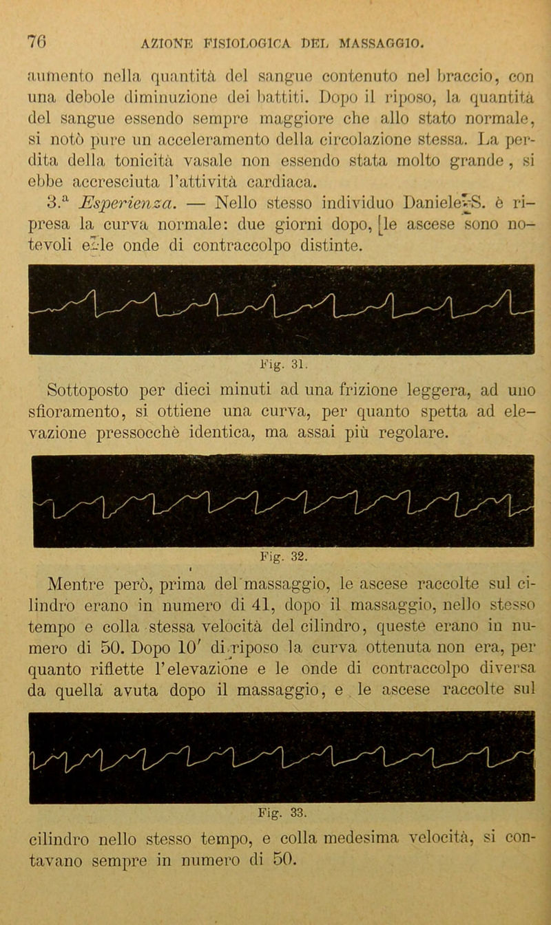 (Umiento nella quantità, del sangue contenuto nel braccio, con una debole diminuzione dei battiti. Dopo il riposo, la quantità del sangue essendo sempre maggiore che allo stato normale, si notò pure un acceleramento della circolazione stessa. La per- dita della tonicità vasale non essendo stata molto grande, si ebbe accresciuta l’attività cardiaca. 3.*^ Esperienza. — Nello stesso individuo DanielevS. è ri- presa la curva normale: due giorni dopo, [le ascese sono no- tevoli el-le onde di contraccolpo distinte. Fig. 31. Sottoposto per dieci minuti ad una frizione leggera, ad uno sfioramento, si ottiene una curva, per quanto spetta ad ele- vazione pressocchè identica, ma assai più regolare. Fig. 32. Mentre però, prima del'massaggio, le ascese raccolte sul ci- lindro erano in numero di 41, dopo il massaggio, nello stesso tempo e colla stessa velocità del cilindro, queste erano in nu- mero di 50. Dopo 10' di/riposo la curva ottenuta non era, per quanto riflette l’elevazione e le onde di contraccolpo diversa da quella avuta dopo il massaggio, e le ascese raccolte sul Fig. 33. cilindro nello stesso tempo, e colla medesima velocità, si con- tavano sempre in numero di 50.