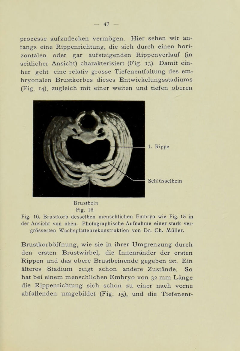 prozesse aufzudecken vermögen. Hier sehen wir an- fangs eine Rippenrichtung, die sich durch einen hori- zontalen oder gar aufsteigenden Rippenverlauf (in seitlicher Ansicht) charakterisiert (Fig. 13). Damit ein- her geht eine relativ grosse Tiefenentfaltung des em- bryonalen Brustkorbes dieses Entwickelungsstadiums (Fig. 14), zugleich mit einer weiten und tiefen oberen 1. Rippe Schlüsselbein Brustbein Fig. 16 Fig. 16. Brustkorb desselben menschlichen Embryo wie Fig. 15 in der Ansicht von oben. Photographische Aufnahme einer stark ver- grösserten Wachsplattenrekonstruktion von Dr. Ch. Müller. Brustkorböffnung, wie sie in ihrer Umgrenzung durch den ersten Brustwirbel, die Innenränder der ersten Rippen und das obere Brustbeinende gegeben ist. Ein älteres Stadium zeigt schon andere Zustände. So hat bei einem menschlichen Embryo von 32 mm Länge die Rippenrichtung sich schon zu einer nach vorne abfallenden umgebildet (Fig. 15), und die Tiefenent-