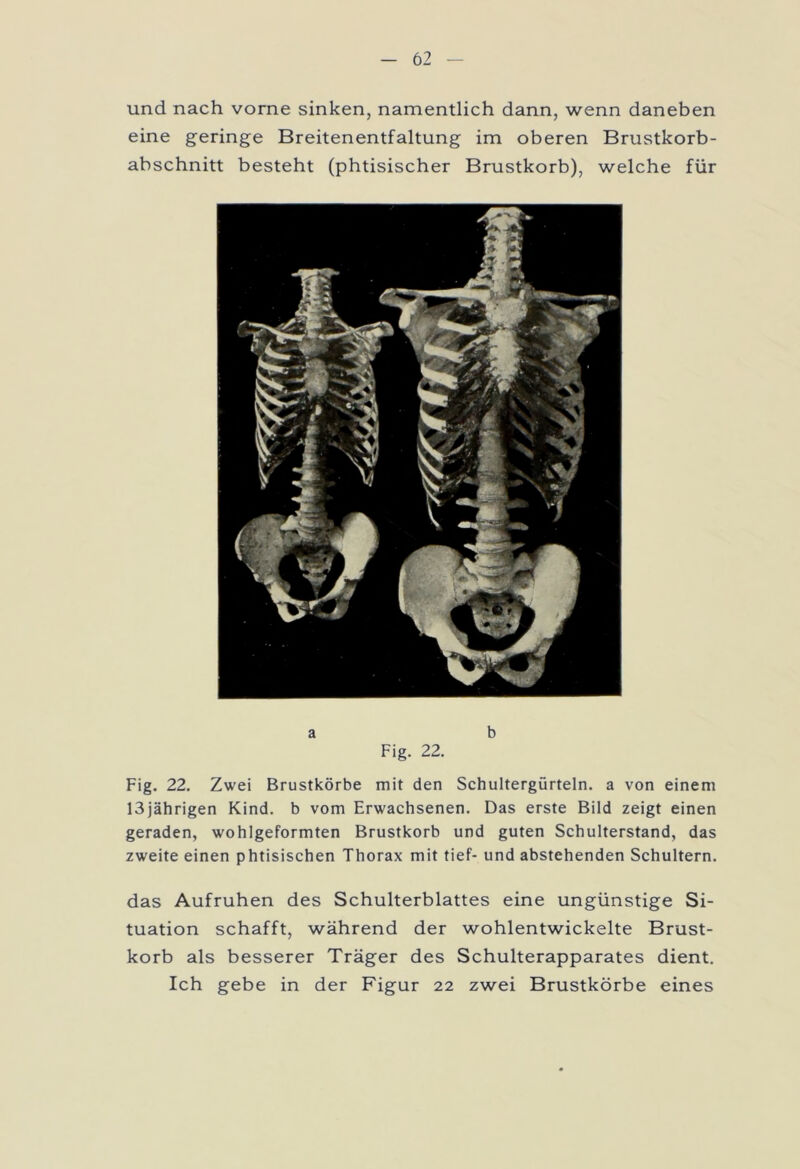 und nach vorne sinken, namentlich dann, wenn daneben eine geringe Breitenentfaltung im oberen Brustkorb- abschnitt besteht (phtisischer Brustkorb), welche für a b Fig. 22. Fig. 22. Zwei Brustkörbe mit den Schultergürteln, a von einem 13jährigen Kind, b vom Erwachsenen. Das erste Bild zeigt einen geraden, wohlgeformten Brustkorb und guten Schulterstand, das zweite einen phtisischen Thorax mit tief- und abstehenden Schultern. das Aufruhen des Schulterblattes eine ungünstige Si- tuation schafft, während der wohlentwickelte Brust- korb als besserer Träger des Schulterapparates dient. Ich gebe in der Figur 22 zwei Brustkörbe eines