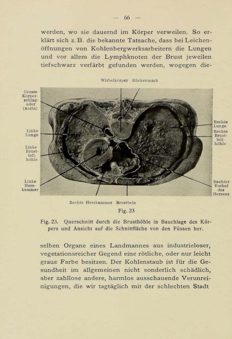 werden, wo sie dauernd im Körper verweilen. So er- klärt sich z. B. die bekannte Tatsache, dass bei Leichen- öffnungen von Kohlenbergwerksarbeitern die Lungen und vor allem die Lymphknoten der Brust jeweilen tiefschwarz verfärbt gefunden werden, wogegen die- Wirbelkörper Rückenmark Grosse Körper- schlag- ader (Aorta) Linke Lunge Linke Brust- fell- höhle Linke Herz- kammer Rechter Vorhof des Herzens Rechte I Lunge Rechte 1 Brust- fell- I höhle Rechte Herzkammer Brustbein Fig. 23 Fig. 23. Querschnitt durch die Brusthöhle in Bauchlage des Kör- pers und Ansicht auf die Schnittfläche von den Füssen her. selben Organe eines Landmannes aus industrieloser, vegetationsreicher Gegend eine rötliche, oder nur leicht graue Farbe besitzen. Der Kohlenstaub ist für die Ge- sundheit im allgemeinen nicht sonderlich schädlich, aber zahllose andere, harmlos ausschauende Verunrei- nigungen, die wir tagtäglich mit der schlechten Stadt