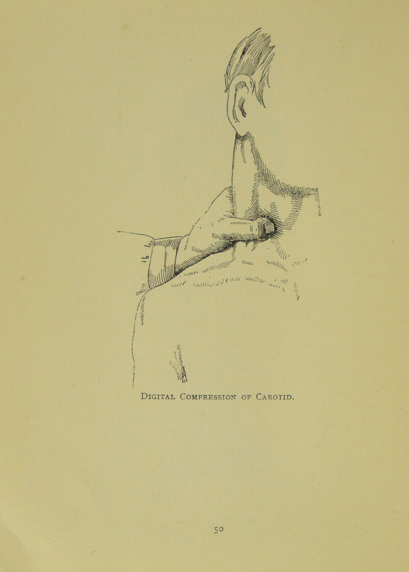 '^00' v SANx ‘4 Digital Compression of Carotid. 53