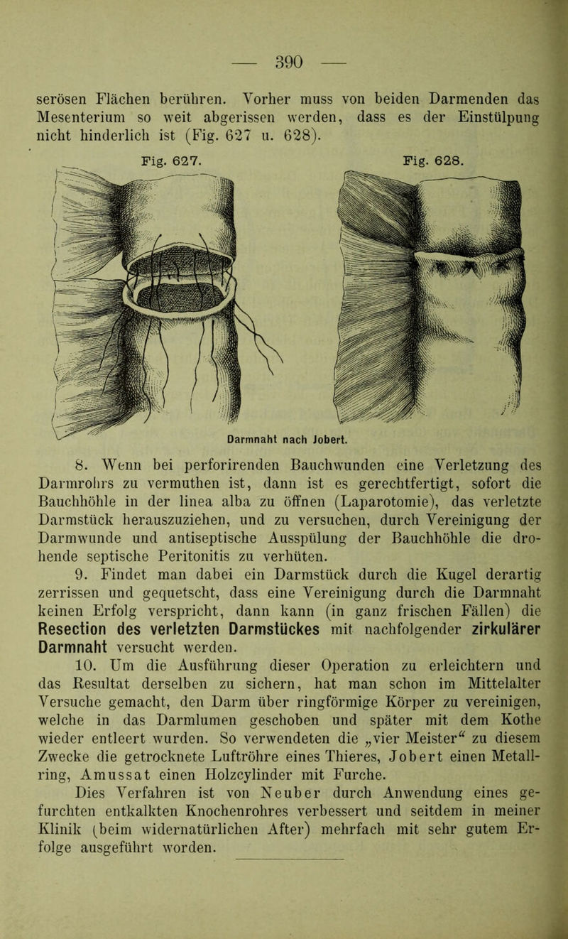 serösen Flächen berühren. Vorher muss von beiden Darmenden das Mesenterium so weit abgerissen werden, dass es der Einstülpung nicht hinderlich ist (Fig. 627 u. 628). 8. Wenn bei perforirenden Bauch wunden eine Verletzung des Darmrohrs zu vermuthen ist, dann ist es gerechtfertigt, sofort die Bauchhöhle in der linea alba zu öffnen (Laparotomie), das verletzte Darmstück herauszuziehen, und zu versuchen, durch Vereinigung der Darmwunde und antiseptische Ausspülung der Bauchhöhle die dro- hende septische Peritonitis zu verhüten. 9. Findet man dabei ein Darmstück durch die Kugel derartig zerrissen und gequetscht, dass eine Vereinigung durch die Darmnaht keinen Erfolg verspricht, dann kann (in ganz frischen Fällen) die Resection des verletzten Darmstückes mit nachfolgender zirkulärer Darmnaht versucht werden. 10. Um die Ausführung dieser Operation zu erleichtern und das Resultat derselben zu sichern, hat man schon im Mittelalter Versuche gemacht, den Darm über ringförmige Körper zu vereinigen, welche in das Darmlumen geschoben und später mit dem Kothe wieder entleert wurden. So verwendeten die „vier Meister^^ zu diesem Zwecke die getrocknete Luftröhre eines Thieres, Jobert einen Metall- ring, Amussat einen Holzcylinder mit Furche. Dies Verfahren ist von Neuber durch Anwendung eines ge- furchten entkalkten Knochenrohres verbessert und seitdem in meiner Klinik (beim widernatürlichen After) mehrfach mit sehr gutem Er- folge ausgeführt worden.