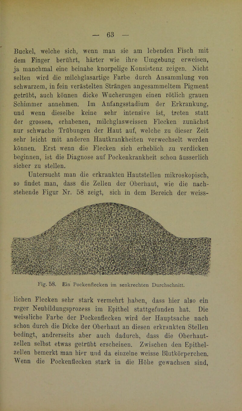 Buckel, welche sieh, wenn man sie am lebenden Fisch mit dem Finger berührt, härter wie ihre Umgebung erweisen, ja manchmal eine beinahe knorpelige Konsistenz zeigen. Nicht selten wird die milchglasartige Farbe durch Ansammlung von schwarzem, in fein verästelten Strängen angesammeltem Pigment getrübt, auch können dicke Wucherungen einen rötlich grauen Schimmer annehmen. Im Anfangsstadium der Erkrankung, und wenn dieselbe keine sehr intensive ist, treten statt der grossen, erhabenen, milchglasweissen Flecken zunächst nur schwache Trübungen der Haut auf, welche zu dieser Zeit sehr leicht mit anderen Hautkrankheiten verwechselt werden können. Erst wenn die Flecken sich erheblich zu verdicken beginnen, ist die Diagnose auf Pockenkrankheit schon äusserlich sicher zu stellen. Untersucht man die erkrankten Hautstellen mikroskopisch, so findet man, dass die Zellen der Oberhaut, wie die nach- stehende Figur Nr. 58 zeigt, sich in dem Bereich der weiss- Fig. 58. Ein Pockenflecken im senkrechten Durchschnitt. liehen Flecken sehr stark vermehrt haben, dass hier also ein reger Neubildungsprozess im Epithel stattgefunden hat. Die weissliche Farbe der Pockenflecken wird der Hauptsache nach schon durch die Dicke der Oberhaut an diesen erkrankten Stellen bedingt, andrerseits aber auch dadurch, dass die Oberhaut- zellen selbst etwas getrübt erscheinen. Zwischen den Epithel- zellen bemerkt man hier und da einzelne weisse Blutkörperchen. Wenn die Pockenflecken stark in die Höhe gewachsen sind.
