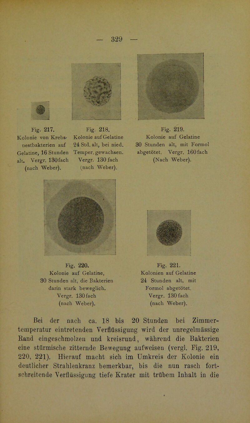 I Fig. 217. Fig. 218. Kolonie von Krebs- Kolonie auf Gelatine oestbakterien auf 24 Std. alt, bei nied. Gelatine, 16 Stunden Temper, gewachsen, alt. Vergr. ISOfach Vergr. 130 fach (nach Weber). (nach Weber). Fig. 220. Kolonie auf Gelatine, 30 Stunden alt, die Bakterien darin stark beweglich. Vergr. 130 fach (nach Weber). Fig. 219. Kolonie auf Gelatine 30 Stunden alt, mit Formol abgetötet. Vergr. 160 fach (Nach Weber). Fig. 221. Kolonien auf Gelatine 24 Stunden alt, mit Formol abgetötet. Vergr. 130 fach (nach Weber). Bei der nach ca. 18 bis 20 Stunden bei Zimraer- teuiperatur eintretenden Verflüssigung wird der unregelmässige Rand eingeschmolzen und kreisrund, während die Bakterien eine stürmische zitternde Bewegung aufweiseu (vergl. Fig. 219, 220, 221). Hierauf macht sich im Umkreis der Kolonie ein deutlicher Strahlenkranz bemerkbar, bis die nun rasch fort- schreitende Verflüssigung tiefe Krater mit trübem Inhalt in die