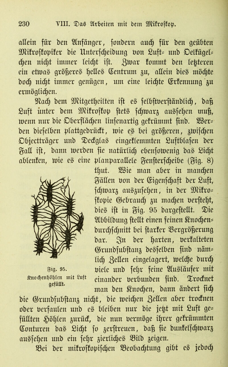 allem für bett Anfänger, fonbent aud) für beit geübten Sltifroffopifer bie Unterfdieibung bon £uft= nnb Delfüget= cCjeu nidfjt immer teidft ift. Stoar fommt bett testeten ein etttmS größeres (fettes ©entrurn gu, allein bie§ modjte bod) tticf)t immer genügen, um eine leichte ©rfennmtg gn ermöglichen. ■Jtacf) bem äJiitgettfeilten ift es fetbftberftänbtich, bag £uft unter bem SKifroffop ftet§ fdpoarg auSfetjen muff, mettn nur bie Oberflächen linfenartig gefrünttnt finb. SBer= ben biefelben plattgebrücft, Utie e§ bei größeren, gtoifdjen Dbjectträger nnb 3)ecfgta§ eingeflemmten Snftbtafen ber galt ift, bann üterben fie natürlich ebenfoioenig ba§ Sicht ablenfen, tbie e§ eine planparattele genfterfdjeibe (gig. 8) t^ut. SBie man aber in manchen gälten bon ber ©igenfdhaft ber £uft, fdjtoarg anSgufeljen, in ber S>cifro= ftopie ©tebraud) gn matten berftetjt, bie§ ift in gig. 95 bargefteHt. SDie Slbbilbuttg ftettt einen feinen Snodjen* burdjfdjuitt bei ftarfer üSergrö^ernng bar. Qn ber garten, bertatteten ©Irunbfubftang be§felben finb itäm= lid) Setten eingelagert, toeldje bnrd) gig. 95. biete nnb fetjr feine StuStäufer mit jtnoc^enijöfjien mit stuft eittanber berbnttben finb. 2/rodnet man ben üttodjen, bann änbert fid) bie ©runbfnbftang nidjt, bie toeidjen Setten ober trocfneit ober berfanten unb eS bteiben nur bie jept mit ßuft ge? füllten $öf)ten gurüd, bie nun bermöge ihrer gefrümmten ©onturen ba§ Sicht fo gerftreuen, bafj fie buntelfd)tüarg au§fe£)en unb eitt feljr gierlidje§ ®ilb geigen. S8ei ber mifroffopifchen ^Beobachtung gibt e§ jeboch