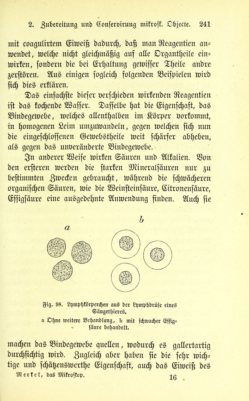 mit coagulirtem ©itoeifs baburdEj, baf3 man 3teagentien am toenbet, toeld^e nidjjt gleichmäßig auf alle Organttjeite ein- toirfen, fonbern bie bei ©r^attnng getoiffer Steile anbre ^erftören. 2lu£ einigen fogteictj folgenben SSeiftrieten toirb fid£) bie§ erftären. 2)a£ einfache biefer öerfcßieben toirfenben 9ieagentten ift ba$ focßenbe SBaffer. Saffelbe hat bie ©igenfdtjaft, ba£ 33inbegett)ebe, toelcheä aftenthatben im Sörper öorfommt, in homogenen Seim umjutoanbeln., gegen tneld^en fidEj nun bie eingefcf)toffenen ©etoebätheite toeit fchärfer abheben, afö gegen ba3 unüeränberte SSinbegetoebe. Sn anberer SGSeife ftirfen Säuren nnb Sltfalien. SSon ben erfteren inerben bie ftarfen Seineratfäuren nur jn beftimmten gtnecfen gebrandet, tnä^renb bie fchiüädfjeren organifd^en Säuren, tnie bie Sßeinfteinfäure, ©itronenfäure, ©ffigfäure eine au§gebehnte Stninenbung finben. 2tuch fie b $ig. 98. Stymptjförperdjen au£ ber Stympfybrüfe eine§ <Sauget^iere§. a Oljtte Weitere S3e^anbtung, b mit fätocu^er @fftg= * fäure be^anbelt. mailen ba§ SBinbegetuebe quellen, tuoburdj e§ gallertartig burdjfidjtig toirb. gugteidij aber Ijaben fte bie fetjr nridfj= tige unb fcCjäi^enötuertbje ®igenf^aft, auctj ba§ ©toeif; be§ SJierlel, ba3 SJiitrottcp. lß