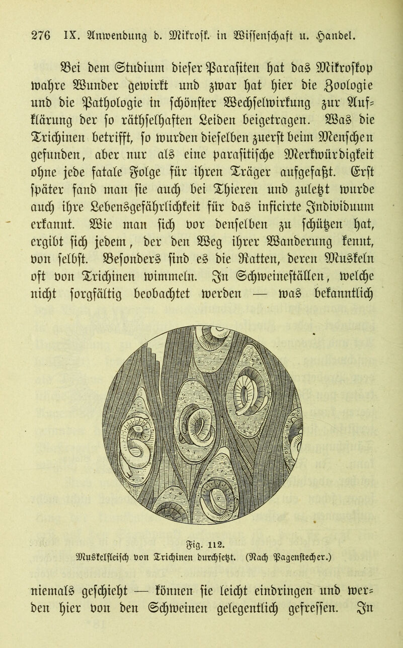 S3ei bem ©tubiurn biefer ißarafiten £»at ba§ üötifroffop lx>at»re SBunber geioirft unb jioar Ijat t)ier bie gootogie unb bie Sßatfyotogie in fdfönfter SBedfjfeltoirfung §ur 9tuf= ftarung ber fo rätljfefljaften Seiben beigetragen. 3Ba§ bie $rid)inen betrifft, fo ttmrben biefetben juerft beim SOtenfdfen gefunben, aber nur als eine parafitifcfje SDterftoürbigfeit ot)ne jebe fatale ffoige für itjren Präger aufgefafft. Gsrft fpäter fanb man fie and) bei Spieren unb julei^t ttrnrbe and) ifjre SebenSgefälfrtidjfeit für ba§ inficirte Qnbiüibuum erfannt. SBie man fid) oor benfetben ju fdjüben tfat, ergibt fid) febem, ber ben SSeg ifjrer SBanberung fcunt, Oon fetbft. SSefonberS finb e§ bie Statten, bereit SKuSfetn oft Oon Sttdjuten ioimmetn. $n ©dfjtoehteftäHen, töeldfje nidjt forgfättig beobachtet trierbett — toa§ befanntiid) gig. 112. 9ftu§!elfleifcf) bott £rtcf)inen burdjfetst. (Sftadj ^agenftecfyer.) niemals gefdfietjt — fönnen fie teicfjt einbringen unb toer= beu hier Oon ben ©düoeinett getegenttidj gefreffen. Sn