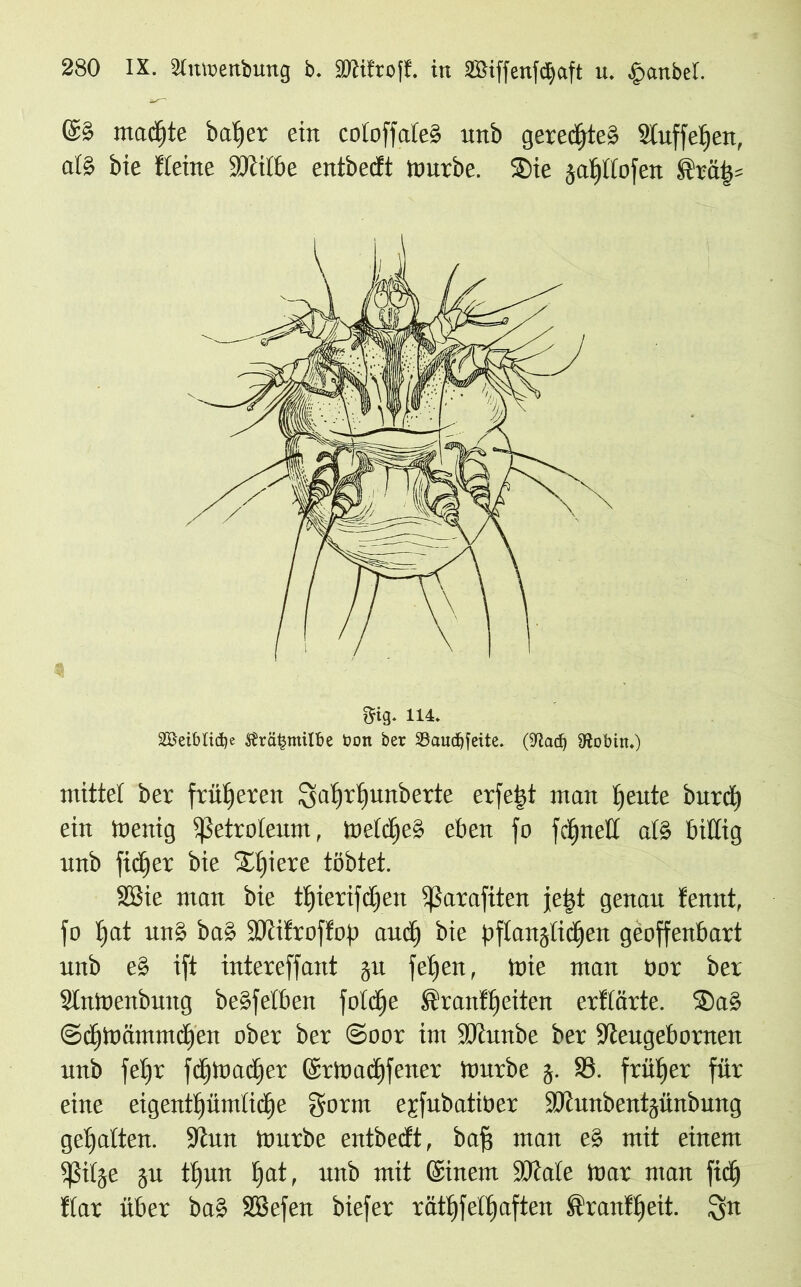 machte baffer ein coloffafe§ unb geredfte§ Sluffeffen, afö bie Keine 9Mbc entbecft Würbe. SDie jalfKofen Krätj= s Sig- n-4- 2BeibIid)e $rä£milbe öoit ber Söauc^feite. (SRadj 9lobin.) mittet ber früheren Safjtifunberte erfe|t man tjeute burdf) ein Wenig Petroleum, Wetdfe§ eben fo fdfnett at§ billig unb fid£>er bie Spiere tobtet. SBie ntan bie tfjierifcffen fßarafiten jetjt genau fennt, fo f»at un§ baö üKiftoffop and) bie pflangtidjeit geoffenbart unb e§ ift intereffant gu felfen, Wie man bor ber 3lnWenbung beleihen fotctfe ä?ranKfeiten erKärte. ®a§ ©dfwämtndfen ober ber Soor im iühutbe ber -Jteugebornen unb felfr fdfwadfer (SrWactffener Würbe 5. 33. früher für eine eigenttfümtidie gorm ejfubatiber SJtunbentjünbung gehalten. 9tun Würbe entbecft, baff man e§ mit einem fßilje §u Kfun Ifat, unb mit @inem SOcaXe War man fidff Kar über ba§ SGßefen biefer rättffetlfaften ftranflfett. Qn