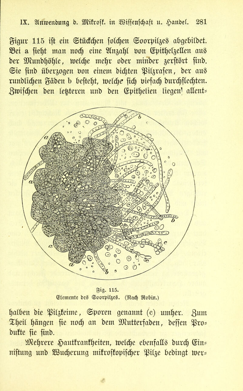 gignr 115 ift ein ©tücfdjen fotzen @oorpüje§ abgebilbet. S3et a fietjt man noc£) eine Stnjaljl t)on GSpitJjeljeßen an£ ber 3Knnbf)öf)le, melcfye meljr ober mtnber ^erftört ftnb. Sie ftnb überzogen Oon einem bitten $ßiK$rafen, ber an£ rnnblidjen gäben b befielt, ttteld^e fidjj öiefadj bnrdjfledjten. Slotfdjen ben (enteren nnb ben (Spitzelten liegen^ aßent* Sfifl. 115. Elemente be§ ©oorbitjeS. (üftad) ütobüt.) falben bie SßiljJetme, Sporen genannt (c) untrer. gnm %ty\{ Rängen fie nod) an bem SKntterfaben, beffen 5ßro^ bnfte fie ftnb. $Jef)rere §antfranff)eiten, toetdje ebenfalls burdj (Stn* niftnng nnb SSndjernng mifroffopifd£)er 5ßilje bebingt toer*