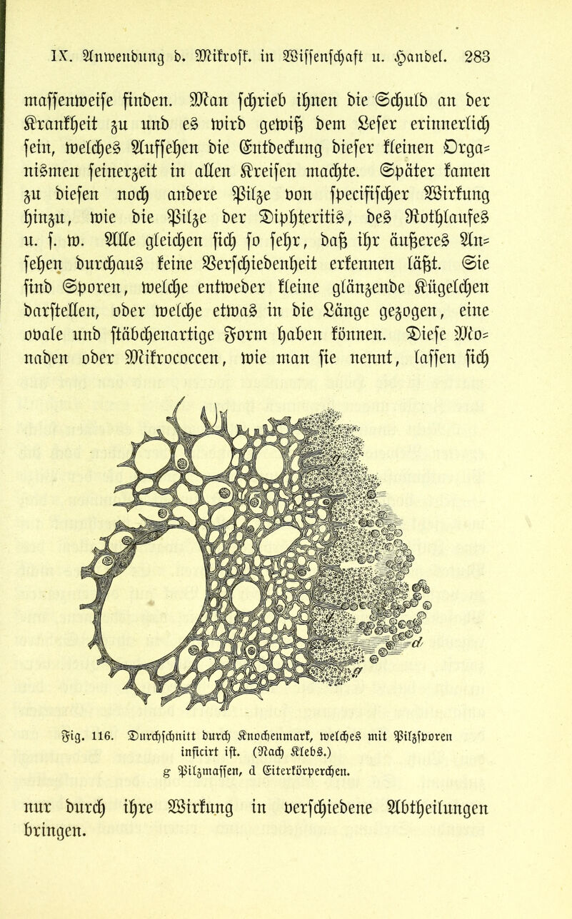 maffenioeife ftrtbext. SJJan fctjrieb irrten bie©djutb an ber ®ranK)eit gn xmb e§> toirb geioif3 bem Sefer erinnerlich fein, ioetcf)e§ Sfnffeljen bie ©ntbecfung biefer Keinen Drga= ni§meit feiner^eit in allen Greifen machte, ©pater famen ju biefen noch cmbere Sßilje bon fpecififcfjer SBirfung hinjn, ioie bie Sßilje ber ®ipt)teriti£, be£ 9tot§tanfe£ it. f. io. Sitte gleichen fich fo fe£)r, baf$ \t)x äufiere£ Stm fefjen bxtrcf)an§ feine SSerfdjiebentjeit erfennen läfjt. Sie finb ©poreit, ioel(f)e entioeber Keine gtän^enbe Sügetdjen barftetten, ober ineiche etioag in bie Sänge gezogen, eine obate unb ftäbdjenartige $orm traben fönnen. ®iefe SKo? naben ober SKifrococcen, ioie man fie nennt, taffen fich $ig. 116. £>urd)fd)nitt burcE) ^nodjenmarf, ir>eXc^e§ mit Sßilgffcoren tnficirt ift. (9Xad) &Ieb§.) g ^ilgmaffen, d ©itetfötperdjen. nur burch ^re SBirfnng in berfdjiebene Slbtffeitungen bringen.