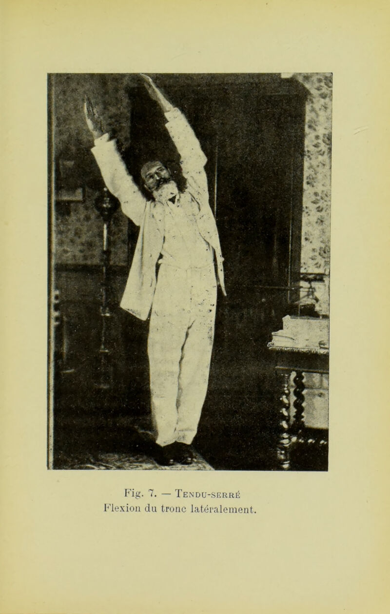 Fig. 7. — Tendu-.serré I‘'lexiou du tronc latéralement.