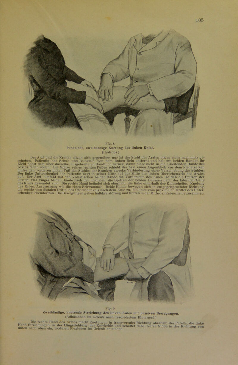 Fig. 8. Pendelnde, zweihändige Knetung des Unken Knies. (Hydrops.) Der Arzt und die Kranke sitzen sich gegenüber, nur ist der Stuhl des Arztes etwas mehr nach links ge- schoben. Patientin hat Schuh und Beinkleid von dem linken Bein entfernt und hält mit beiden Händen ihr Kleid nebst dem über dasselbe ausgebreiteten Handtuch zurück, damit diese nicht in die arbeitenden Hände des Arztes faUen sollen. Die Spitze seines rechten Fußes schiebt der Arzt einen AugenbUck vor dem Niedersetzen hinter den vorderen linken Fuß des Stuhles der Kranken zwecks Verhinderung einer Verschiebung des Stuhles. Der linke Unterschenkel der Patientin liegt in seiner Mitte auf der Mitte des linken Oberschenkels des Arztes auf. Der Arzt umfaßt mit den Volarflächen beider Hände die Vorderseite des Knies, so daß die Spitzen der letzten vier Finger beider Hände nach der medialen, die Spitzen der beiden Daumen nach der lateralen Seite des Knies gewendet sind. Die rechte Hand befindet sich oberhalb, die Unke unterhalb der Kniescheibe. Knetung des Knies, Auspressung wie die eines Schwammes. Beide Hände bewegen sich in entgegengesetzter Richtung, die rechte vom distalen Drittel des Oberschenkels nach dem Knie zu, die Unke vom proximalen Drittel des Unter- schenkels ebendorthin. Die Bewegungen gehen halbkreisfönnig und treffen in der Mitte der Kniescheibe zusammen. Fig. ». Zweihändige, knetende Streichung des Unken Knies mit passiven Bewegungen. (Adhäsionen im Gelenk nacli resorbiertem Bluterguß.) u 1 oP'*? Hand des Arztes macht Knetungen in transversaler Richtung oberhalb der Patella, die linke Hand Streichungen m der Längsrichtung der Kniekehle und schaltet dabei kurze Slüße in der Richtung von unten nach oben ein, wodurch Flexionen im Gelenk entstehen.