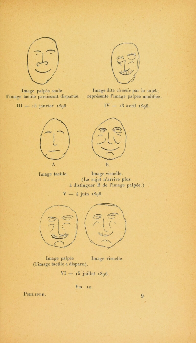 Image palpée seule l’image tactile paraissant disparue. III — i5 janvier 1896. Image dite visuelle par le sujet ; représente l’image pa'pée modifiée. IV — i3 avril 1896. Image tactile. Image visuelle. (Le sujet n’arrive plus à distinguer B de l’image palpée.) V — 4 juin 1896. Image palpée (l’image tactile a disparu). Image visuelle. VI — i5 juillet 1896. Fig. 10. Philippe. 9
