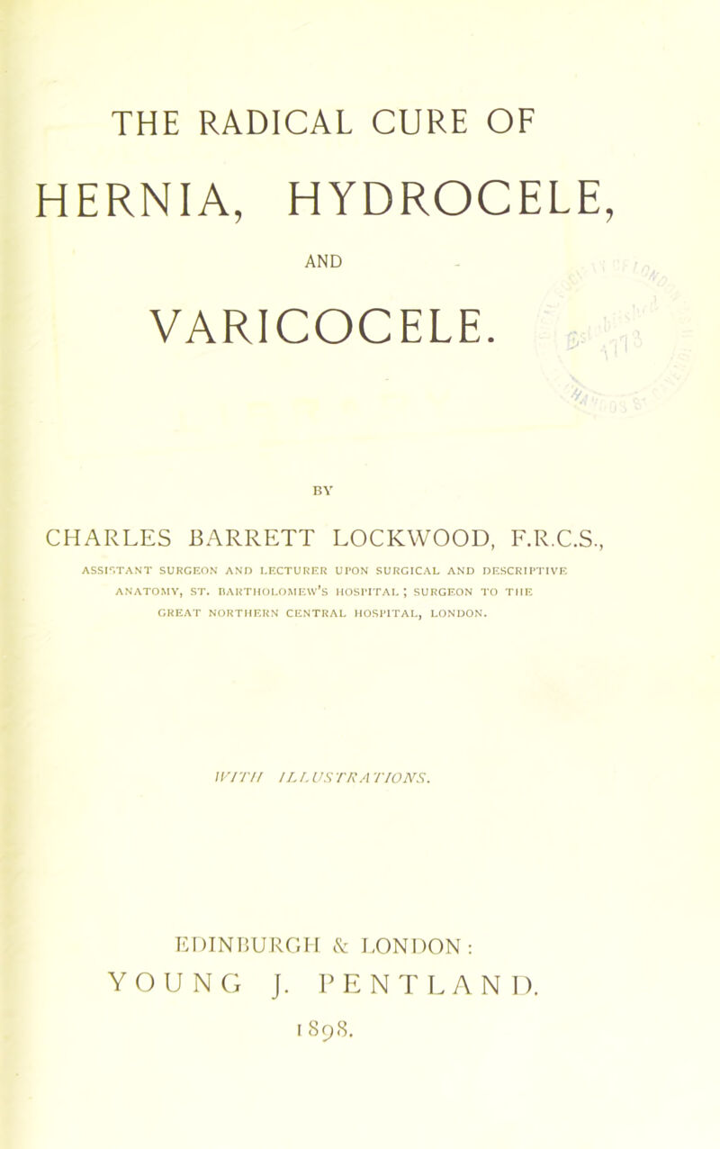 THE RADICAL CURE OF HERNIA, HYDROCELE, AND VARICOCELE. CHARLES BARRETT LOCKWOOD, F.R.C.S., ASSISTANT SURGEON AND LECTURER UPON SURGICAL AND DESCRIPTIVE ANATOMY, ST. BARTHOLOMEW’S HOSPITAL *, SURGEON TO THE GREAT NORTHERN CENTRAL HOSPITAL, LONDON. WITH ILL US TRA TIONS. EDINBURGH & LONDON: YOUNG J. PE NT LAN I). 1898.