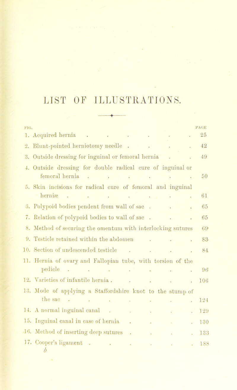 LIST OF ILLUSTRATIONS. FIG. PAGE 1. Acquired hernia . . . . . .25 2. Blunt-pointed herniotomy needle . . . .42 3. Outside dressing for inguinal or femoral hernia . . 49 4. Outside dressing for double radical cure of inguinal or femoral hernia . . . . . .50 5. Skin incisions for radical cure of femoral and inguinal hernke . . . . . . .61 3. Polypoid bodies pendent from wall of sac . . .65 7. Relation of polypoid bodies to wall of sac . . .65 8. Method of securing the omentum with interlocking sutures 69' 9. Testicle retained within the abdomen . . .83' 10. Section of undescended testicle . . . .84 11. Hernia of ovary and Fallopian tube, with torsion of the pedicle . . . . . . .96 12. Varieties of infantile hernia . .... 106 13. Mode of applying a Staffordshire knot to the stump of the sac . . . . . . .124 14. A normal inguinal canal . . . . .129 15. Inguinal canal in case of hernia ... 130 16. Method of inserting deep sutures .... 133 17. Cooper’s ligament ...... 188 b