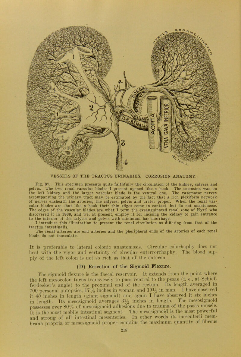 VESSELS OF THE TRACTUS URINARIUS. CORROSION ANATOMY. Fig. 87. This specimen presents quite faithfully the circulation of the kidney, calyces and pelvis. The two renal vascular blades I present opened like a book. The corrosion was on the left kidney and the larger vascular blade is the ventral one. The vasomotor nerves accompanying the urinary tract may be estimated by the fact that a rich plexiform network of nerves ensheath the arteries, the calyces, pelvis and ureter proper. When the renal vas- cular blades are shut like a book their thin edges come in contact, but do not anastomose. The edges of the vascular blades are what I term the exsanguinated renal zone of Hyrtl who discovered it in 1868, and we, at present, employ it for incising the kidney to gain entrance to the interior of the calyces and pelvis with minimum hae morrhage. I introduce this illustration to present the renal circulation as differing from that of the tractus intestinalis. The renal arteries are end arteries and the pheripheral ends of the arteries of each renal blade do not inosculate. It is preferable to lateral colonic anastomosis. Circular eolorhaphy does not heal with the vigor and certainty of circular enterrorrhaphy. The blood sup- ply of the left colon is not so rich as that of the enteron. (D) Resection of the Sigmoid Flexure. The sigmoid flexure is the faecal reservoir. It extends from the point where the left mesocolon turns transvesely to pass ventral to the psoas (i. e., at Schief- ferdeeker’s angle) to the proximal end of the rectum. Its length averaged in 700 personal autopsies, 171/2 inches in woman and 19i/> in man. I have observed it 40 inches in length (giant sigmoid) and again I have observed it six inches in length. Its mesosigmoid averages 3i/> inches in length. The mesosigmoid possesses over 80% of mesosigmoid adhesions due to trauma of the psoas muscle. It is the most mobile intestinal segment. The mesosigmoid is the most powerful and strong of all intestinal mesenteries. In other words its mesenterii mem- brana propria or mesosigmoid proper contains the maximum quantity of fibrous