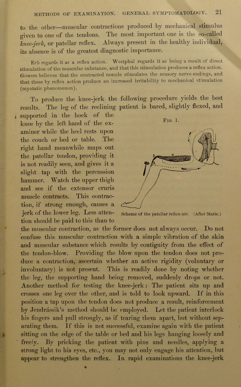 to the other—muscular contractions produced by mechanical stimulus given to one of the tendons. The most important one is the so-called knee-jerk, or patellar reflex. Always present in the healthy individual, its absence is of the greatest diagnostic importance. Erb regards it as a reflex action. Westphal regards it as being a result of direct stimulation of the muscular substance, and that this stimulation produces a reflex action. Gowers believes that the contracted muscle stimulates the sensory nerve-endings, and that these by reflex action produce an increased irritability to mechanical stimulation (myotatic phenomenon). To produce the knee-jerk the following procedure yields the best results. The leg of the reclining patient is bared, slightly flexed, and supported in the hock of the knee by the left hand of the ex- aminer while the heel rests upon the couch or bed or table. The right hand meanwhile maps out the patellar tendon, providing it is not readily seen, and gives it a slight tap with the percussion hammer. Watch the upper thigh and see if the extensor cruris muscle contracts. This contrac- tion, if strong enough, causes a jerk of the lower leg. Less atteu- Scheme of the patellar reiiex-arc. (After Marie.) tion should be paid to this than to the muscular contraction, as the former does not always occur. Do not confuse this muscular contraction with a simple vibration of the skin and muscular substance which results by contiguity from the effect of the tendon-blow. Providing the blow upon the tendon does not pro- duce a contraction, ascertain whether an active rigidity (voluntary or involuntary) is not present. This is readily done by noting whether the leg, the supporting hand being removed, suddenly drops or not. Another method for testing the knee-jerk: The patient sits up and crosses one leg over the other, and is told to look upward. If in this position a tap upon the tendon does not produce a result, reinforcement by Jendrassik’s method should be employed. Let the patient interlock his fingers and pull strongly, as if tearing them apart, but without sep- arating them. If this is not successful, examine again with the patient sitting on the edge of the table or bed and his legs hanging loosely and freely. By pricking the patient with pins and needles, applying a strong light to his eyes, etc., you may not only engage his attention, but appear to strengthen the reflex. In rapid examinations the knee-jerk