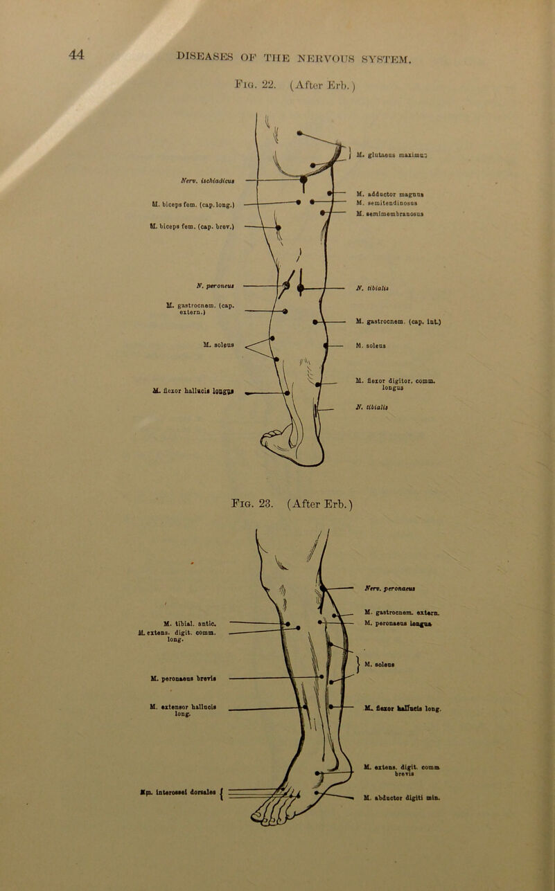 Fig. 22. (After Erb.) New. i&chiadicua U. biceps fem. (cap. long.) M. biceps fem. (cap. brev.) N. peroneus M. ga8trocnem. (cap. extern.) M. aoleu9 AL flexor hallucis loilgpj j M. glutaoua maxima'; M. adductor magnna M. aemitendinosus M. semimembranosus N. tibia li* M. gastrocnem. (cap. iut) M. soleu3 M. flexor digitor. comm. longua N. tibialis Fig. 23. (After Erb.) Nero, peronaeus M. gastrocnem. extern. M. peronaeus Longa* M. Bolens M. flexor haUuels long. M. extens. digit, comm brevis M. abductor digit! min.