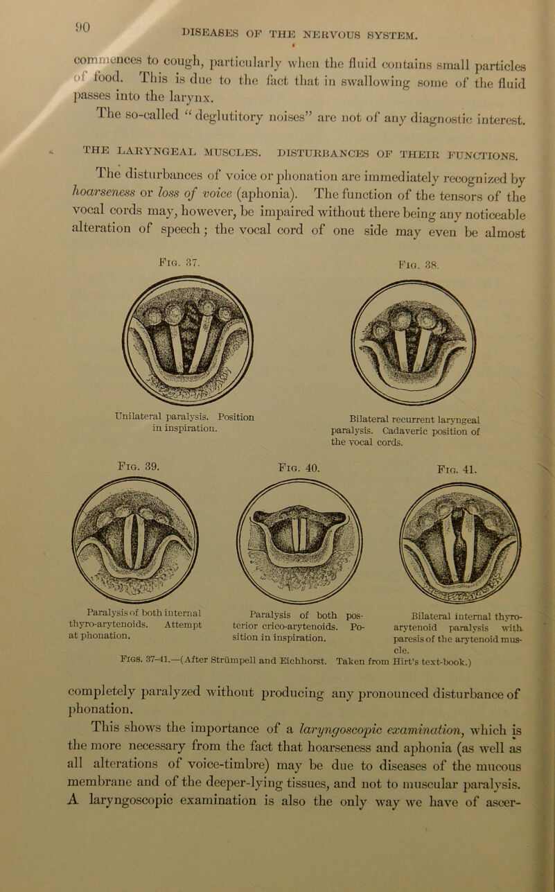 DO diseases of the nervous system. commences to cough, particularly when the fluid contains small particles lood. Phis is due to the fact that in swallowing some of the fluid passes into the larynx. The so-called “ deglutitory noises” are not of any diagnostic interest. the laryngeal muscles, disturbances of their functions. The disturbances of voice or phonation are immediately recognized by hoarseness or loss of voice (aphonia). The function of the tensors of the vocal cords may, however, be impaired without there being any noticeable alteration of speech; the vocal cord of one side may even be almost Fig. 37. Fig. 38. Unilateral paralysis. Position in inspiration. Bilateral recurrent laryngeal paralysis. Cadaveric position of the vocal cords. Fig. 39. Fig. 40. Fig. 41. ifeyvBv Paralysis of both internal Paralysis of both pos- thyro-arytenoids. Attempt terior crico-arytenoids. Po- at phonation. sition in inspiration. Figs. 37-41.—(After Striimpell and Eichhorst. Taken Bilateral internal thyro- arytenoid paralysis with paresis of the arytenoid mus- cle. from Hirt’s text-book.) completely paralyzed without producing any pronounced disturbance of phonation. This shows the importance of a laryngoscopic examination, which is the more necessary from the fact that hoarseness and aphonia (as well as all alterations of voice-timbre) may be due to diseases of the mucous membrane and of the deeper-lying tissues, and not to muscular paralysis. A laryngoscopic examination is also the only way we have of ascer-