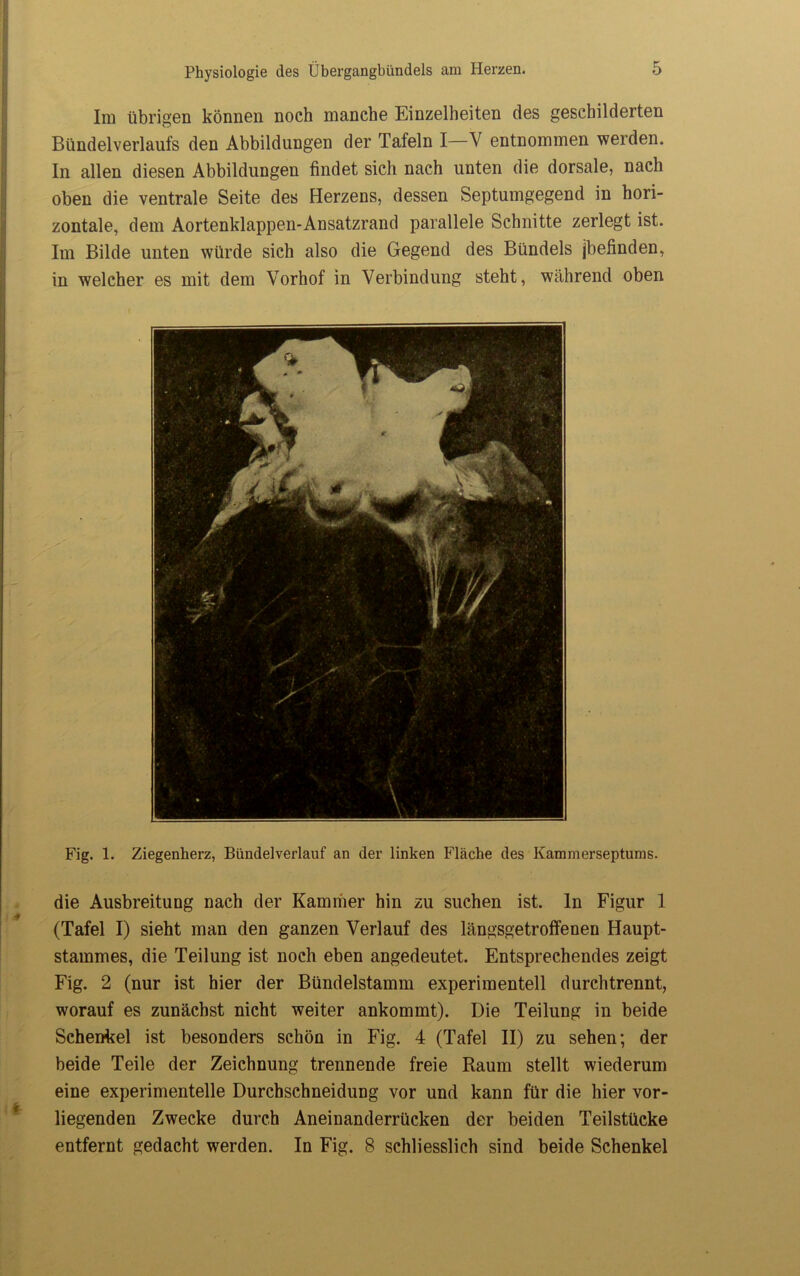 Im übrigen können noch manche Einzelheiten des geschilderten Bündelverlaufs den Abbildungen der Tafeln I—'V entnommen werden. In allen diesen Abbildungen findet sich nach unten die dorsale, nach oben die ventrale Seite des Herzens, dessen Septumgegend in hori- zontale, dem Aortenklappen-Ansatzrand parallele Schnitte zerlegt ist. Im Bilde unten würde sich also die Gegend des Bündels jbefinden, in welcher es mit dem Vorhof in Verbindung steht, während oben Fig. 1. Ziegenberz, Bündelverlauf an der linken Fläche des Kammerseptums. die Ausbreitung nach der Kammer hin zu suchen ist. ln Figur 1 (Tafel I) sieht man den ganzen Verlauf des längsgetroffenen Haupt- stammes, die Teilung ist noch eben angedeutet. Entsprechendes zeigt Fig. 2 (nur ist hier der Bündelstamm experimentell durch trennt, worauf es zunächst nicht weiter ankommt). Die Teilung in beide Schenkel ist besonders schön in Fig. 4 (Tafel II) zu sehen; der beide Teile der Zeichnung trennende freie Raum stellt wiederum eine experimentelle Durchschneidung vor und kann für die hier vor- liegenden Zwecke durch Aneinanderrücken der beiden Teilstücke entfernt gedacht werden. In Fig. 8 schliesslich sind beide Schenkel
