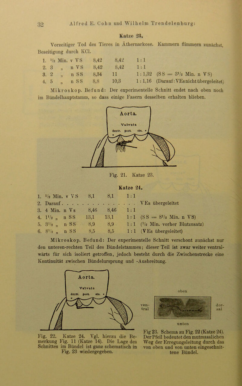 Kat/e 28. Vorzeitiger Tod des Tieres in Äthernarkose. Kammern flimmern zunächst, Beseitigung durch KCl. 1. Va Min. V VS 8,42 8,42 1 : 1 2. 3 n n VS 8,42 8,42 1 : 1 3. 2 >7 n SS 8,34 11 1 : 1,32 (SS = 3Va Min. n VS) 4. 5 77 n SS 8,8 10,3 1 : 1,16 (Darauf: VEs nicht übergeleitet; Mikroskop. Befund: Der experimentelle Schnitt endet nach oben noch im Bündelhauptstamm, so dass einige Fasern desselben erhalten blieben. 1. Va Min. v VS 2. Darauf.... 3. 4 Min. n V s IV« „ n SS 3Va „ n SS 8,1 8,1 1 : 1 4. 5. 6. 8Va n SS 8,46 13,1 8,9 8,5 8,46 13,1 8,9 8,5 1 : 1 1 : 1 1 : 1 1 : 1 VEs übergeleitet (SS = 8Va Min. n VS) (Va Min. vorher Blutzusatz) (VEs übergeleitet) Mikroskop. Befund: Der experimentelle Schnitt verschont zunächst nur den unter en-rechten Teil des Bündelstammes; dieser Teil ist zwar weiter ventral- wärts für sich isoliert getroffen, jedoch besteht durch die Zwischenstrecke eine Kontinuität zwischen Bündelursprung und -Ausbreitung. Fig. 22. Katze 24. Vgl. hierzu die Be- merkung Fig. 11 (Katze 14). Die Lage des Schnittes im Bündel ist ganz schematisch in Fig. 23 wiedergegeben. oben ven- tral dor- sal unten Fig 23. Schema zu Fig. 22 (Katze 24). Der Pfeil bedeutet den mutmasslichen Weg der Erregungsleitung durch das von oben und von unten eingeschnit- tene Bündel.