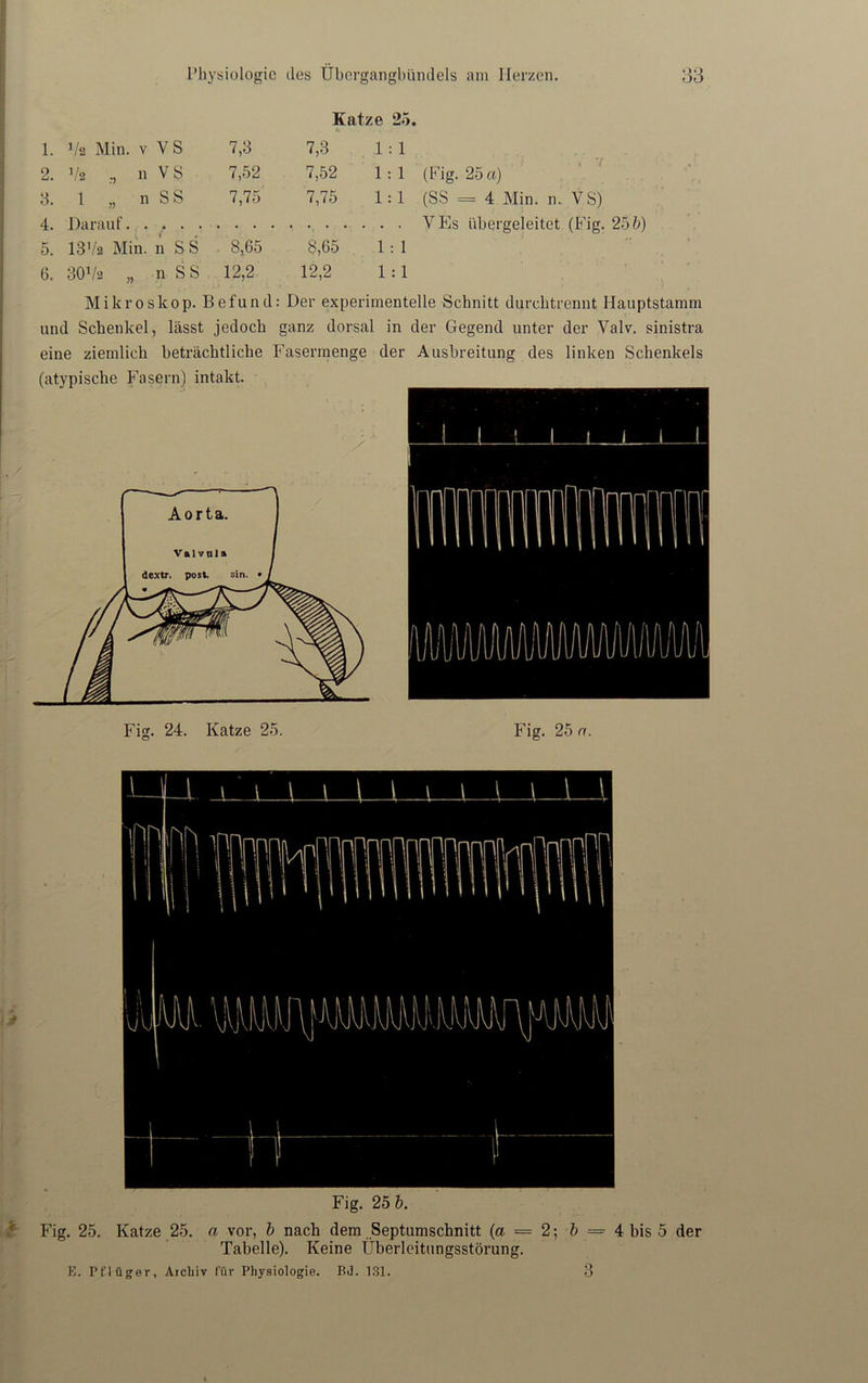 V Katze 25. 2. Va :, n V S 7,52 7,52 1 : 1 (Fig. 25 a) * / 4. Darauf. . VEs iibergeleitct (Fig. 25 b) 5. 13Va Min. n SS . 8,65 8,65 1 : 1 6. 30V*' » n SS 12,2 12,2 1 : 1 Mikroskop. Befund: Der experimentelle Schnitt durchtrennt Hauptstamm und Schenkel, lässt jedoch ganz dorsal in der Gegend unter der Valv. sinistra Fig. 24. Katze 25. Fig. 25 n. Fig. 25. Katze 25. a vor, b nach dem Septumschnitt (a = 2; b — 4 bis 5 der Tabelle). Keine Überleitungsstörung. B. Pflüger, Archiv für Physiologie. BJ. 131. 3