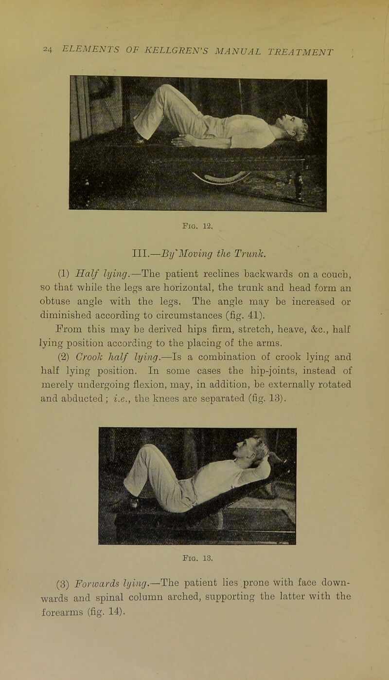 Fig. 12. III.—By'Moving the Trunk. (1) Half lying.—The patient reclines backwards on a couch, so that while the legs are horizontal, the trunk and head form an obtuse angle with the legs. The angle may be increased or diminished according to circumstances (fig. 41). From this may be derived hips firm, stretch, heave, &c., half lying position according to the placing of the arms. (2) Crook half lying.—Is a combination of crook lying and half lying position. In some cases the hip-joints, instead of merely undergoing flexion, may, in addition, be externally rotated and abducted; i.e., the knees are separated (fig. 13). Fig. 13. (3) Forwards lying.—The patient lies prone with face down- wards and spinal column arched, supporting the latter with the forearms (fig. 14).