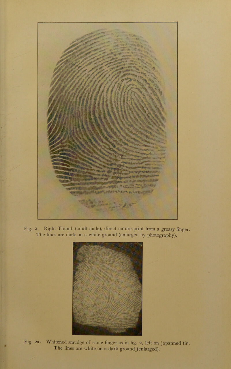 2. Right Thumb (adult male), direct nature-print from a greasy finger. The lines are dark on a white ground (enlarged by photography). 2a. Whitened smudge of same finger as in fig. 2, left on japanned tin. The lines are white on a dark ground (enlarged).