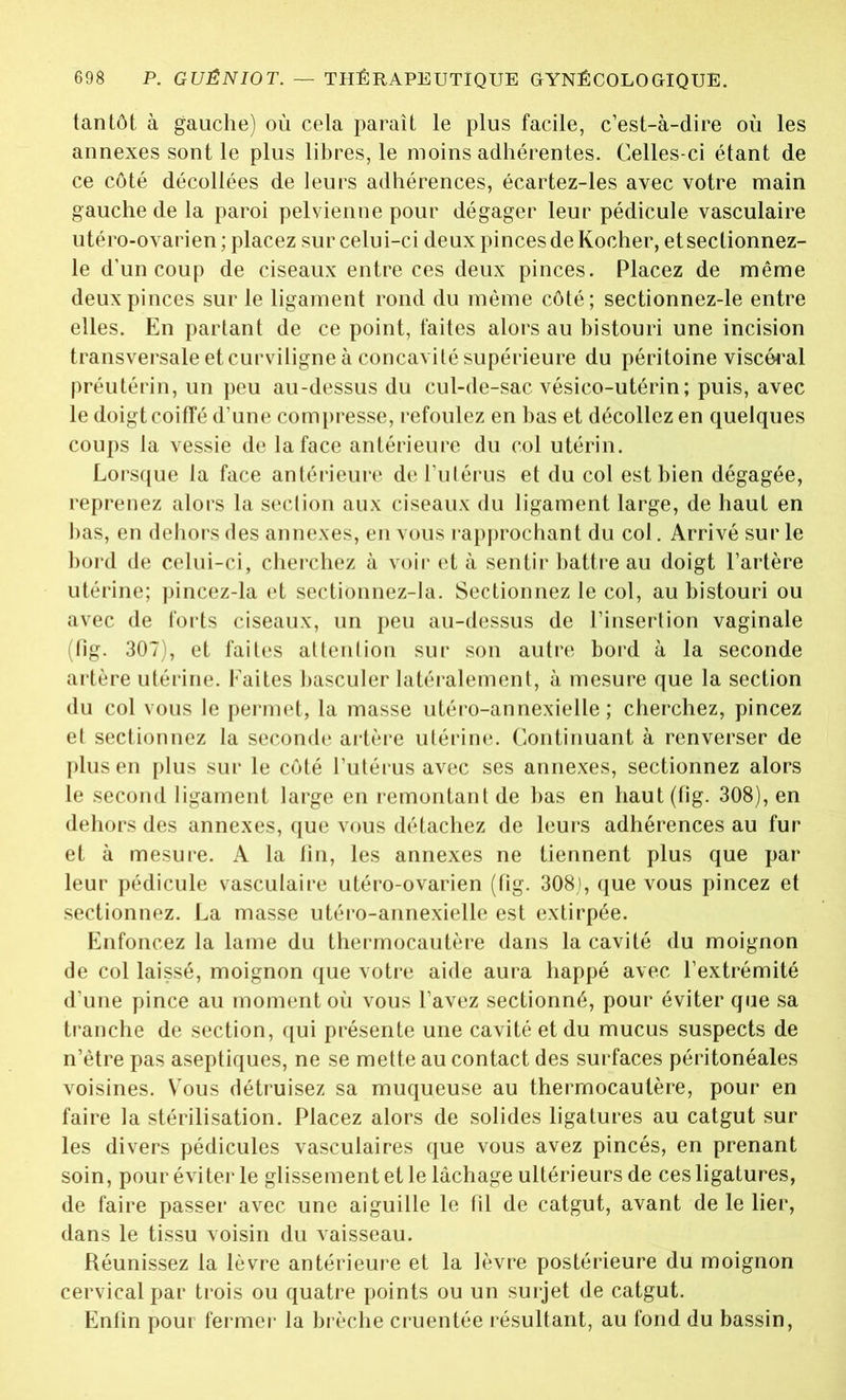 tantôt à gauche) où cela paraît le plus facile, c’est-à-dire où les annexes sont le plus libres, le moins adhérentes. Celles-ci étant de ce côté décollées de leurs adhérences, écartez-les avec votre main gauche de la paroi pelvienne pour dégager leur pédicule vasculaire utéro-ovarien ; placez sur celui-ci deux pinces de Kocher, et sectionnez- le d’un coup de ciseaux entre ces deux pinces. Placez de même deux pinces sur le ligament rond du même côté; sectionnez-le entre elles. En partant de ce point, faites alors au bistouri une incision transversale et curviligne à concavité supérieure du péritoine viscéral préutérin, un peu au-dessus du cul-de-sac vésico-utérin; puis, avec le doigt coiffé d’une compresse, refoulez en bas et décollez en quelques coups la vessie de la face antérieure du col utérin. Lorsque la face antérieure de l’utérus et du col est bien dégagée, reprenez alors la section aux ciseaux du ligament large, de haut en bas, en dehors des annexes, en vous rapprochant du col. Arrivé sur le bord de celui-ci, cherchez à voir et à sentir battre au doigt l’artère utérine; pincez-la et sectionnez-la. Sectionnez le col, au bistouri ou avec de forts ciseaux, un peu au-dessus de l’insertion vaginale (fig. 307), et faites attention sur son autre bord à la seconde artère utérine. Faites basculer latéralement, à mesure que la section du col vous le permet, la masse utéro-annexielle ; cherchez, pincez et sectionnez la seconde artère utérine. Continuant à renverser de plus en plus sur le côté l’utérus avec ses annexes, sectionnez alors le second ligament large en remontant de bas en haut (fig. 308), en dehors des annexes, que vous détachez de leurs adhérences au fur et à mesure. A la fin, les annexes ne tiennent plus que par leur pédicule vasculaire utéro-ovarien (Fig. 308), que vous pincez et sectionnez. La masse utéro-annexielle est extirpée. Enfoncez la lame du thermocautère dans la cavité du moignon de col laissé, moignon que votre aide aura happé avec l’extrémité d’une pince au moment où vous l’avez sectionné, pour éviter que sa tranche de section, qui présente une cavité et du mucus suspects de n’ètre pas aseptiques, ne se mette au contact des surfaces péritonéales voisines. Y’ous détruisez sa muqueuse au thermocautère, pour en faire la stérilisation. Placez alors de solides ligatures au catgut sur les divers pédicules vasculaires que vous avez pincés, en prenant soin, pour éviter le glissement et le lâchage ultérieurs de ces ligatures, de faire passer avec une aiguille le Fil de catgut, avant de le lier, dans le tissu voisin du vaisseau. Réunissez la lèvre antérieure et la lèvre postérieure du moignon cervical par trois ou quatre points ou un surjet de catgut. Enfin pour fermer la brèche cruentée résultant, au fond du bassin,