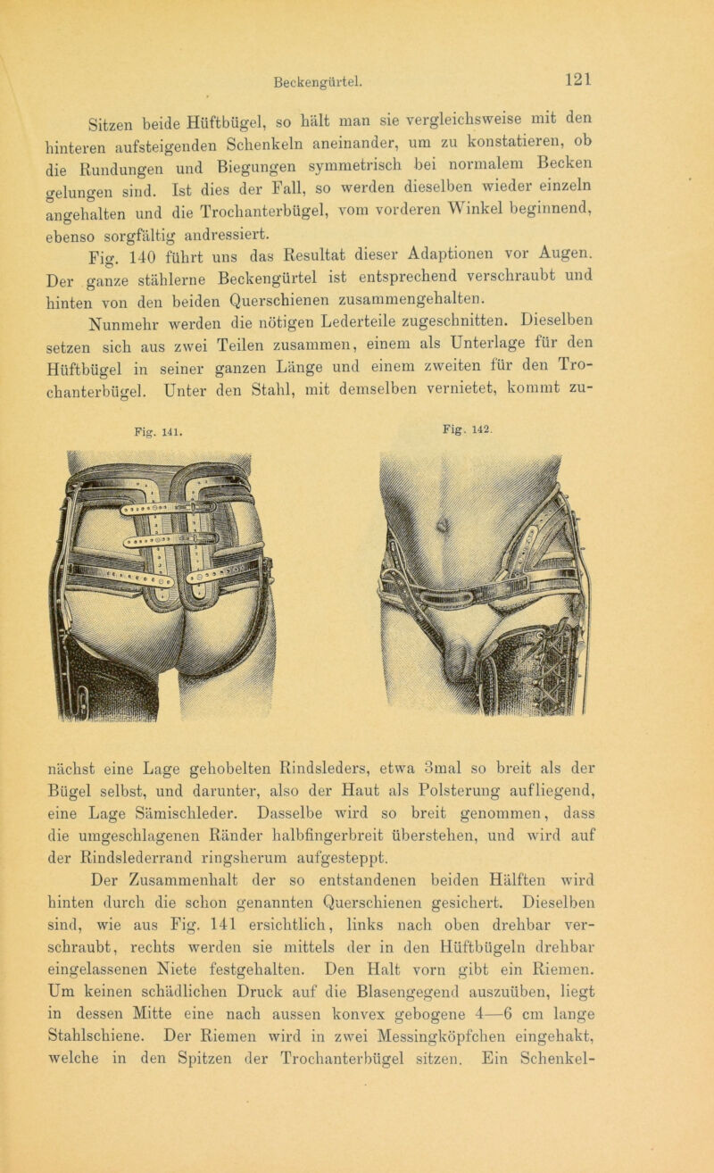 Beckengürtel. Sitzen beide Hüftbügel, so hält man sie vergleichsweise mit den hinteren aufsteigenden Schenkeln aneinander, um zu konstatieren, ob die Rundungen und Biegungen symmetrisch bei normalem Becken gelungen sind. Ist dies der Fall, so werden dieselben wieder einzeln angehalten und die Trochanterbügel, vom vorderen Winkel beginnend, ebenso sorgfältig andressiert. Fier 140 führt uns das Resultat dieser Adaptionen vor Augen. Der ganze stählerne Beckengürtel ist entsprechend verschraubt und hinten von den beiden Querschienen zusammengehalten. Nunmehr werden die nötigen Lederteile zugeschnitten. Dieselben setzen sich aus zwei Teilen zusammen, einem als Unterlage für den Hüftbügel in seiner ganzen Länge und einem zweiten für den Tro- chanterbügel. Unter den Stahl, mit demselben vernietet, kommt zu- Fig. 141. Fig. 142. nächst eine Lage gehobelten Rindsleders, etwa 3mal so breit als der Bügel selbst, und darunter, also der Haut als Polsterung aufliegend, eine Lage Sämischleder. Dasselbe wird so breit genommen, dass die umgeschlagenen Ränder halbfingerbreit überstellen, und wird auf der Rindslederrand ringsherum aufgesteppt. Der Zusammenhalt der so entstandenen beiden Hälften wird hinten durch die schon genannten Querschienen gesichert. Dieselben sind, wie aus Fig« 141 ersichtlich, links nach oben drehbar ver- schraubt, rechts werden sie mittels der in den Hüftbügeln drehbar eingelassenen Niete festgehalten. Den Halt vorn gibt ein Riemen. Um keinen schädlichen Druck auf die Blasengegend auszuüben, liegt in dessen Mitte eine nach aussen konvex gebogene 4—6 cm lange Stahlschiene. Der Riemen wird in zwei Messingköpfchen eingehakt, welche in den Spitzen der Trochanterbügel sitzen. Ein Schenkel-