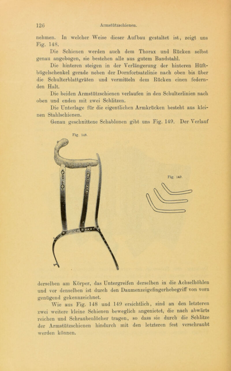 nehmen. In welcher Weise dieser Aufbau gestaltet ist, zeigt uns Fig. 148. Die Schienen werden auch dem Thorax und Rücken selbst genau angebogen, sie bestehen alle aus gutem Bandstahl. Die hinteren steigen in der Verlängerung der hinteren Hüft- bügelschenkel gerade neben der Dornfortsatzlinie nach oben bis über die Schulterblattgräten und vermitteln dem Rücken einen federn- den Halt. Die beiden Armstützschienen verlaufen in den Schulterlinien nach oben und enden mit zwei Schlitzen. Die Unterlage für die eigentlichen Armkrücken besteht aus klei- nen Stahl schienen. Genau geschnittene Schablonen gibt uns Fig. 149. Der Verlauf Fig. 148. derselben am Körper, das Untergreifen derselben in die Achselhöhlen und vor denselben ist durch den DaumenzeigefingerhebegrifF von vorn genügend gekennzeichnet. Wie aus Fig. 148 und 149 ersichtlich, sind an den letzteren zwei weitere kleine Schienen beweglich angenietet, die nach abwärts reichen und Schraubenlöcher tragen, so dass sie durch die Schlitze der Armstützschienen hindurch mit den letzteren fest verschraubt werden können.