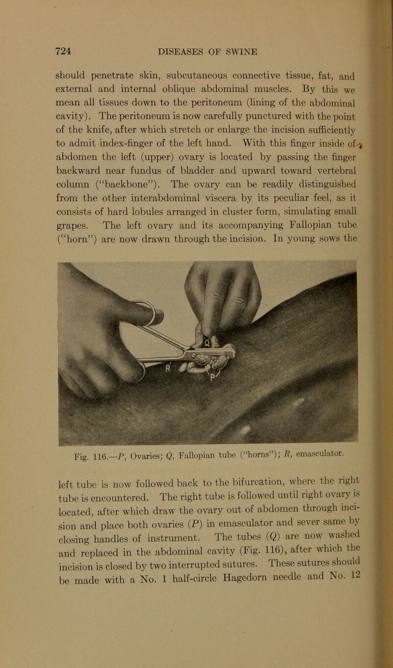 should penetrate skin, subcutaneous connective tissue, fat, and external and internal oblique abdominal muscles. By this we mean all tissues down to the peritoneum (lining of the abdominal cavity). The peritoneum is now carefully punctured with the point of the knife, after which stretch or enlarge the incision sufficiently to admit index-finger of the left hand. With this finger inside of-* abdomen the left (upper) ovary is located by passing the finger backward near fundus of bladder and upward toward vertebral column (“backbone”). The ovary can be readily distinguished from the other interabdominal viscera by its peculiar feel, as it consists of hard lobules arranged in cluster form, simulating small grapes. The left ovary and its accompanying Fallopian tube (“horn”) are now drawn through the incision. In young sows the Fig. 116.—P, Ovaries; Q, Fallopian tube (“horns”); R, emasculator. left tube is now followed back to the bifurcation, where the right tube is encountered. The right tube is followed until right ovary is located, after which draw the ovary out of abdomen through inci- sion and place both ovaries (P) in emasculator and sever same by closing handles of instrument. The tubes (Q) are now washed and replaced in the abdominal cavity (Fig. 116), after which the incision is closed by two interrupted sutures. These sutures should be made with a No. 1 half-circle Hagedorn needle and No. 12