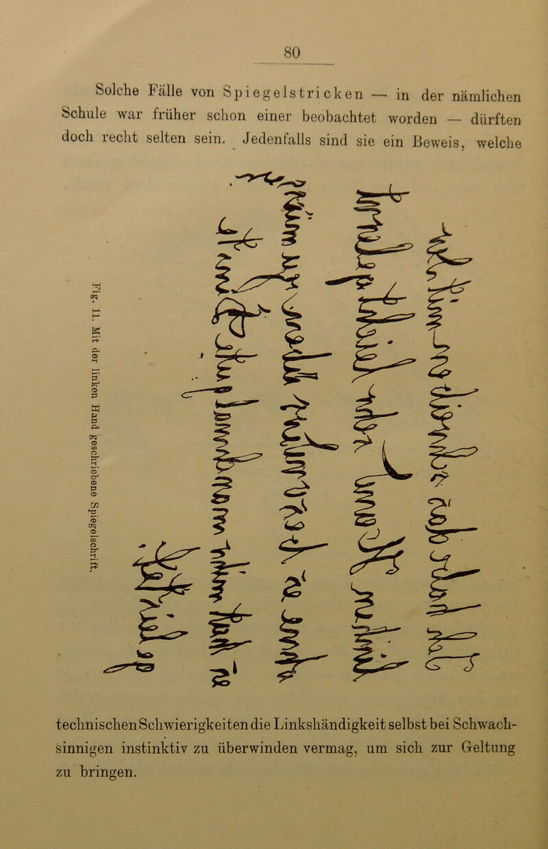 Solche Fälle von Spiegelstricken — in der nämlichen Schule war früher schon einer beobachtet worden — dürften doch recht selten sein. Jedenfalls sind sie ein Beweis, welche technischen Schwierigkeit en die Linkshändigkeit selbst bei Schwach- sinnigen instinktiv zu überwinden vermag, um sich zur Geltung zu bringen.