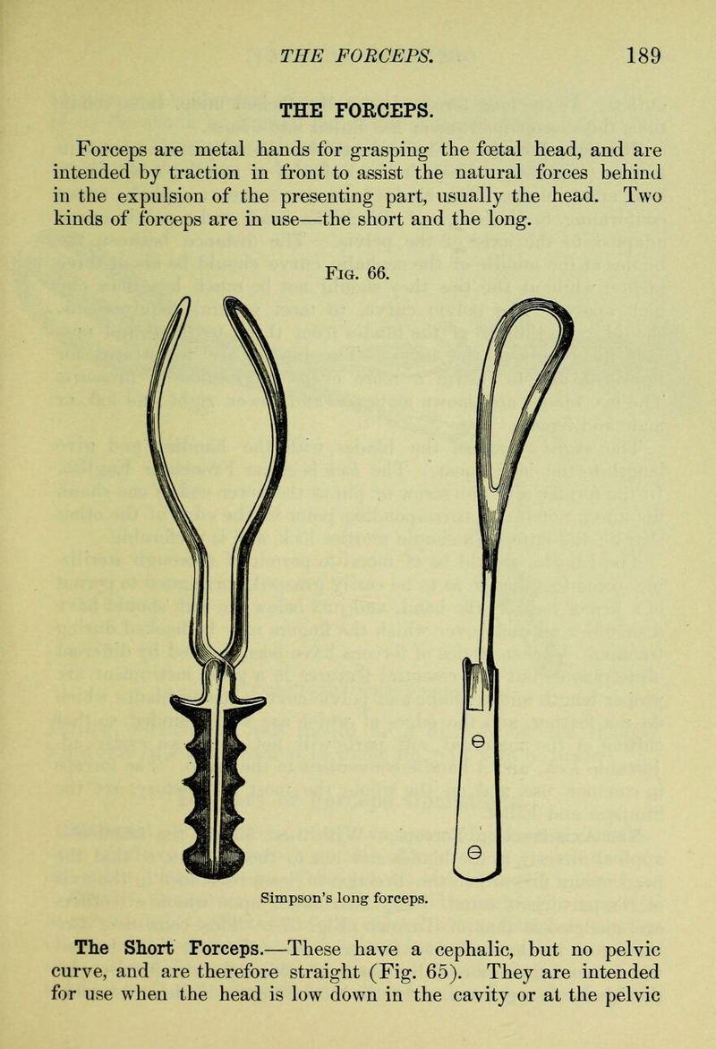 THE FORCEPS. Forceps are metal hands for grasping the foetal head, and are intended by traction in front to assist the natural forces behind in the expulsion of the presenting part, usually the head. Two kinds of forceps are in use—the short and the long. Fig. 66. Simpson’s long forceps. The Short Forceps.—These have a cephalic, but no pelvic curve, and are therefore straight (Fig. 65). They are intended for use when the head is low down in the cavity or at the pelvic