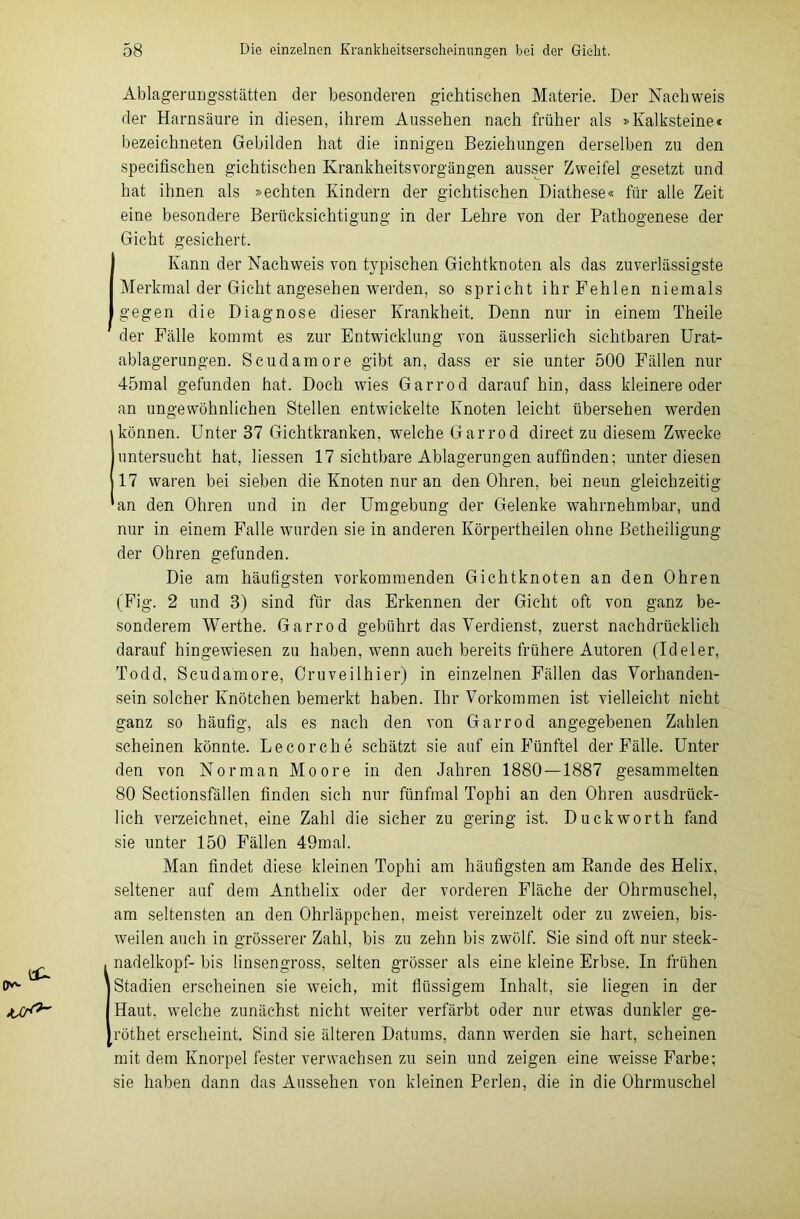 Ablagerangsstätten der besonderen gichtischen Materie. Der Nachweis der Harnsäure in diesen, ihrem Aussehen nach früher als »Kalksteine« bezeiehneten Gebilden hat die innigen Beziehungen derselben zu den specifischen gichtischen Krankheitsvorgängen ausser Zweifel gesetzt und hat ihnen als »echten Kindern der gichtischen Diathese« für alle Zeit eine besondere Berücksichtigung in der Lehre von der Pathogenese der Gicht gesichert. Kann der Nachweis von typischen Gichtknoten als das zuverlässigste Merkmal der Gicht angesehen werden, so spricht ihr Fehlen niemals gegen die Diagnose dieser Krankheit. Denn nur in einem Theile der Fälle kommt es zur Entwicklung von äusserlich sichtbaren Urat- ablagerungen. Scuclamore gibt an, dass er sie unter 500 Fällen nur 45mal gefunden hat. Doch wies Garrod darauf hin, dass kleinere oder an ungewöhnlichen Stellen entwickelte Knoten leicht übersehen werden jkönnen. Unter 37 Gichtkranken, welche Garrod direct zu diesem Zwecke untersucht hat, liessen 17 sichtbare Ablagerungen auffinden; unter diesen 17 waren bei sieben die Knoten nur an den Ohren, bei neun gleichzeitig 'an den Ohren und in der Umgebung der Gelenke wahrnehmbar, und nur in einem Falle wurden sie in anderen Körpertheilen ohne Betheiligung der Ohren gefunden. Die am häufigsten vorkommenden Gichtknoten an den Ohren (Fig. 2 und 3) sind für das Erkennen der Gicht oft von ganz be- sonderem Werthe. Garrod gebührt das Verdienst, zuerst nachdrücklich daraufhingewiesen zu haben, wenn auch bereits frühere Autoren (Ideler, Todd, Scudamore, Cruveilhier) in einzelnen Fällen das Vorhanden- sein solcher Knötchen bemerkt haben. Ihr Vorkommen ist vielleicht nicht ganz so häufig, als es nach den von Garrod angegebenen Zahlen scheinen könnte. Lecorche schätzt sie auf ein Fünftel der Fälle. Unter den von Norman Moore in den Jahren 1880 — 1887 gesammelten 80 Sectionsfällen finden sich nur fünfmal Tophi an den Ohren ausdrück- lich verzeichnet, eine Zahl die sicher zu gering ist. Duckworth fand sie unter 150 Fällen 49mal. Man findet diese kleinen Tophi am häufigsten am Rande des Helix, seltener auf dem Anthelix oder der vorderen Fläche der Ohrmuschel, am seltensten an den Ohrläppchen, meist vereinzelt oder zu zweien, bis- weilen auch in grösserer Zahl, bis zu zehn bis zwölf. Sie sind oft nur steck- nadelkopf- bis linsengross, selten grösser als eine kleine Erbse. In frühen Stadien erscheinen sie weich, mit flüssigem Inhalt, sie liegen in der Haut, welche zunächst nicht weiter verfärbt oder nur etwas dunkler ge- röthet erscheint. Sind sie älteren Datums, dann werden sie hart, scheinen mit dem Knorpel fester verwachsen zu sein und zeigen eine weisse Farbe; sie haben dann das Aussehen von kleinen Perlen, die in die Ohrmuschel