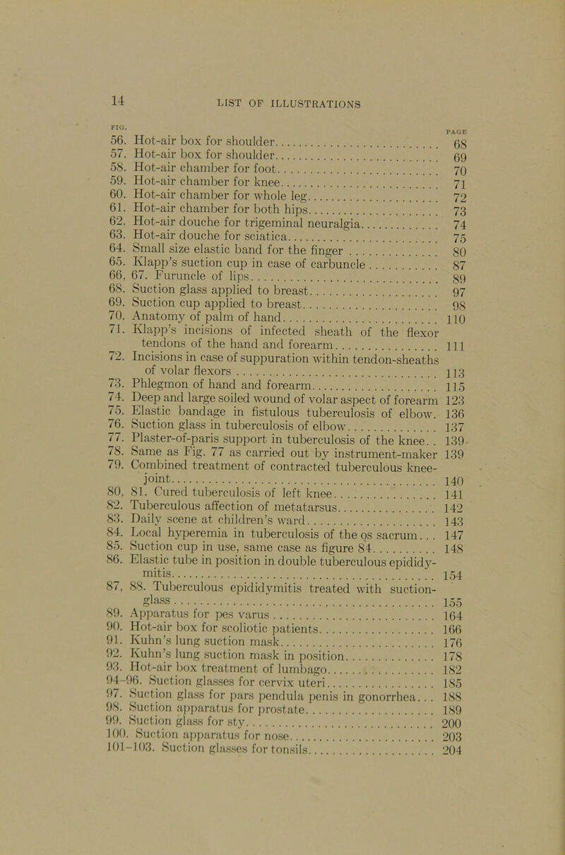 56. Hot-air box for shoulder gg 57. Hot-air box for shoulder gg 58. Hot-air chamber for foot 70 59. Hot-air chamber for knee 71 60. Hot-air chamber for whole leg 72 61. Hot-air chamber for both hips 73 62. Hot-air douche for trigeminal neuralgia 74 63. Hot-air douche for sciatica 75 64. Small size elastic band for the finger go 65. Klapp’s suction cup in case of carbuncle 87 66. 67. Furuncle of lips gg 68. Suction glass applied to breast g7 69. Suction cup applied to breast gg 70. Anatomy of palm of hand 110 71. Klapp’s incisions of infected sheath of the flexor tendons of the hand and forearm ill 72. Incisions in case of suppuration within tendon-sheaths of volar flexors 113 73. Phlegmon of hand and forearm 115 74. Deep and large soiled wound of volar aspect of forearm 123 75. Elastic bandage in fistulous tuberculosis of elbow. 136 76. Suction glass in tuberculosis of elbow 137 77. Plaster-of-paris support in tuberculosis of the knee. . 139 78. Same as Fig. 77 as carried out by instrument-maker 139 79. Combined treatment of contracted tuberculous knee- joint 140 80. 81. Cured tuberculosis of left knee 141 82. Tuberculous affection of metatarsus 142 83. Daily scene at children’s ward 143 84. Local hyperemia in tuberculosis of the os sacrum. . . 147 85. Suction cup in use, same case as figure 84 148 86. Elast ic tube in position in double tuberculous epididy- mitis _ 154 87. 88. Tuberculous epididymitis treated with suction- glass 155 89. Apparatus for pes varus ig4 90. Hot-air box for scoliotic patients 166 91. Kuhn’s lung suction mask 176 92. Kuhn’s lung suction mask in position 178 93. Hot-air box treatment of lumbago 182 94-96. Suction glasses for cervix uteri 185 97. Suction glass for pars pendula penis in gonorrhea.. . 188 98. Suction apparatus for prostate 189 99. Suction glass for sty 200 100. Suction apparatus for nose 203 101-103. Suction glasses for tonsils 204