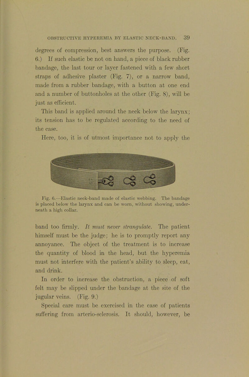 degrees of compression, best answers the purpose. (Fig. 6.) If such elastic be not on hand, a piece of black rubber bandage, the last tour or layer fastened with a few short straps of adhesive plaster (Fig. 7), or a narrow band, made from a rubber bandage, with a button at one end and a number of buttonholes at the other (Fig. 8), will be just as efficient. This band is applied around the neck below the larynx; its tension has to be regulated according to the need of the case. Here, too, it is of utmost importance not to apply the Fig. 6.—Elastic neck-band made of elastic webbing. The bandage is placed below the larynx and can be worn, without showing, under- neath a high collar. band too firmly. It must never strangulate. The patient himself must be the judge; he is to promptly report any annoyance. The object of the treatment is to increase the quantity of blood in the head, but the hyperemia must not interfere with the patient’s ability to sleep, eat, and drink. In order to increase the obstruction, a piece of soft felt may be slipped under the bandage at the sice of the jugular veins. (Fig. 9.) Special care must be exercised in the case of patients suffering from arterio-sclerosis. It should, however, be