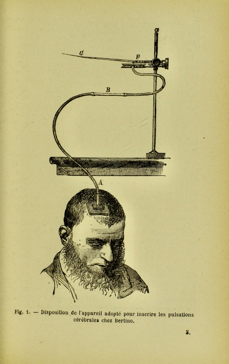 Fig. 1. Disposition de l’appareil adopté pour inscrire les pulsations cérébrales chez Bertino.