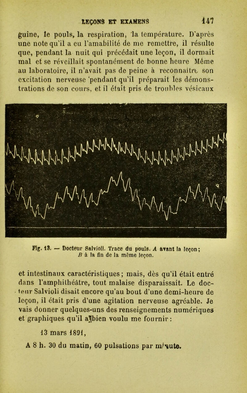 guine, le pouls, la respiration, la température. D’après une note qu’il a eu l’amabilité de me remettre, il résulte que, pendant la nuit qui précédait une leçon, il dormait mal et se réveillait spontanément de bonne heure Même au laboratoire, il n’avait pas de peine à reconnaître son excitation nerveuse 'pendant qu’il préparait les démons- trations de son cours, et il était pris de troubles vésicaux Fig. 13. — Docteur Salvioli. Trace du pouls. A avant la leçon; ^ à la fin de la même leçon. et intestinaux caractéristiques; mais, dès qu’il était entré dans l’amphithéâtre, tout malaise disparaissait. Le doc- teur Salvioli disait encore qu’au bout d’une demi-heure de leçon, il était pris d’une agitation nerveuse agréable. Je vais donner quelques-uns des renseignements numériques et graphiques qu’il ajjbien voulu me fournir: 13 mars 1891, A 8 h. 30 du matin, 60 pulsations par rn/’ïute.
