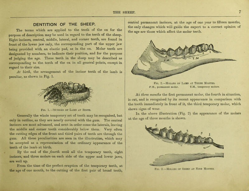 DENTITION OF THE SHEEP. The terms which are applied to the teeth of the ox for the purpose of description may be used in regal’d to the teeth of the sheep. Eight incisors, central, middle, lateral, and corner teeth, are found in front of the lower jaw only, the corresponding part of the upper jaw being provided with an elastic pad, as in the ox. Molar teeth are designated by numbers, to indicate their position, and for the purpose of judging the age. These teeth in the sheep may be described as corresponding to the teeth of the ox in all general points, except in regard to their size. At birth, the arrangement of the incisor teeth of the lamb is peculiar, as shown in Fig. 1. Fig. 1.—Incisors op Lamb at Birth. Generally the whole temporary set of teeth may be recognised, but only in outline, as they are nearly covered with the gum. The central incisors are most advanced, and next in order come the laterals, leaving the middle and corner teeth considerably below them. Very often the cutting edges of the front and third pairs of teeth are through the gum. All these peculiarities are seen in the illustration, which may be accepted as a representation of the ordinary appearance of the teeth of the lamb at birth. By the end of the fourth week all the temporary teeth, eight incisors, and three molars on each side of the upper and lower jaws, are well up. From the time of the perfect eruption of the temporary teeth, at the age of one month, to the cutting of the first pair of broad teeth, central permanent incisors, at the age of one year to fifteen months, the only changes which will guide the expert to a correct opinion of the age are those which affect the molar teeth. Fig. 2.—Molars op Lamb at Three Months. P.M., permanent molar. T.M., temporary molars. At three months the first permanent molar, the fourth in situation, is cut, and is recognised by its recent appearance in comparison with the tooth immediately in front of it, the third temporary molar, which shows signs of wear. In the above illustration (Fig. 2) the appearance of the molars at the age of three months is shown. Fig. 3.—Molars op Sheep at Nine Months.