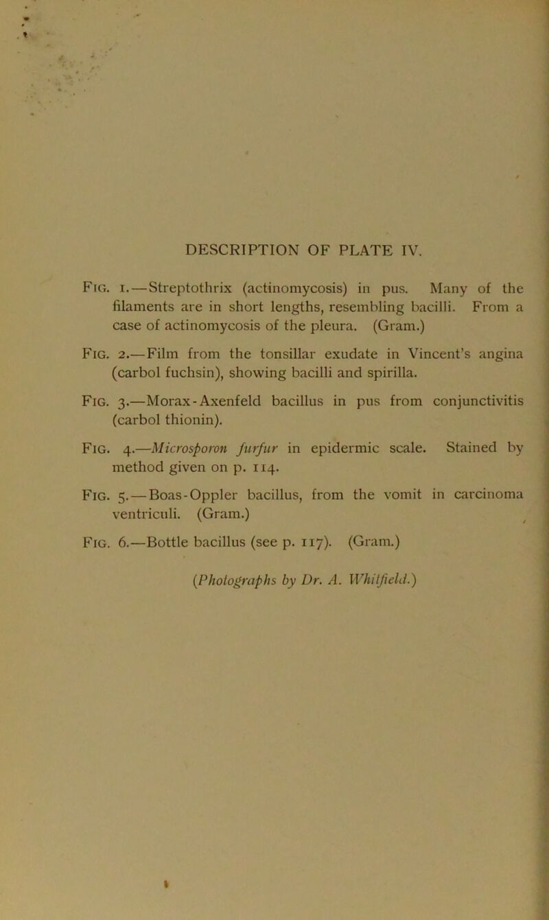 Fig. i.—Streptothrix (actinomycosis) in pus. Many of the filaments are in short lengths, resembling bacilli. From a case of actinomycosis of the pleura. (Gram.) Fig. 2.—Film from the tonsillar exudate in Vincent’s angina (carbol fuchsin), showing bacilli and spirilla. Fig. 3.—Morax-Axenfeld bacillus in pus from conjunctivitis (carbol thionin). Fig. 4.—Microsporon furfur in epidermic scale. Stained by method given on p. 114. Fig. 5. — Boas-Oppler bacillus, from the vomit in carcinoma ventriculi. (Gram.) Fig. 6.—Bottle bacillus (see p. 117). (Gram.) [Photographs by Dr. A. Whitfield.)
