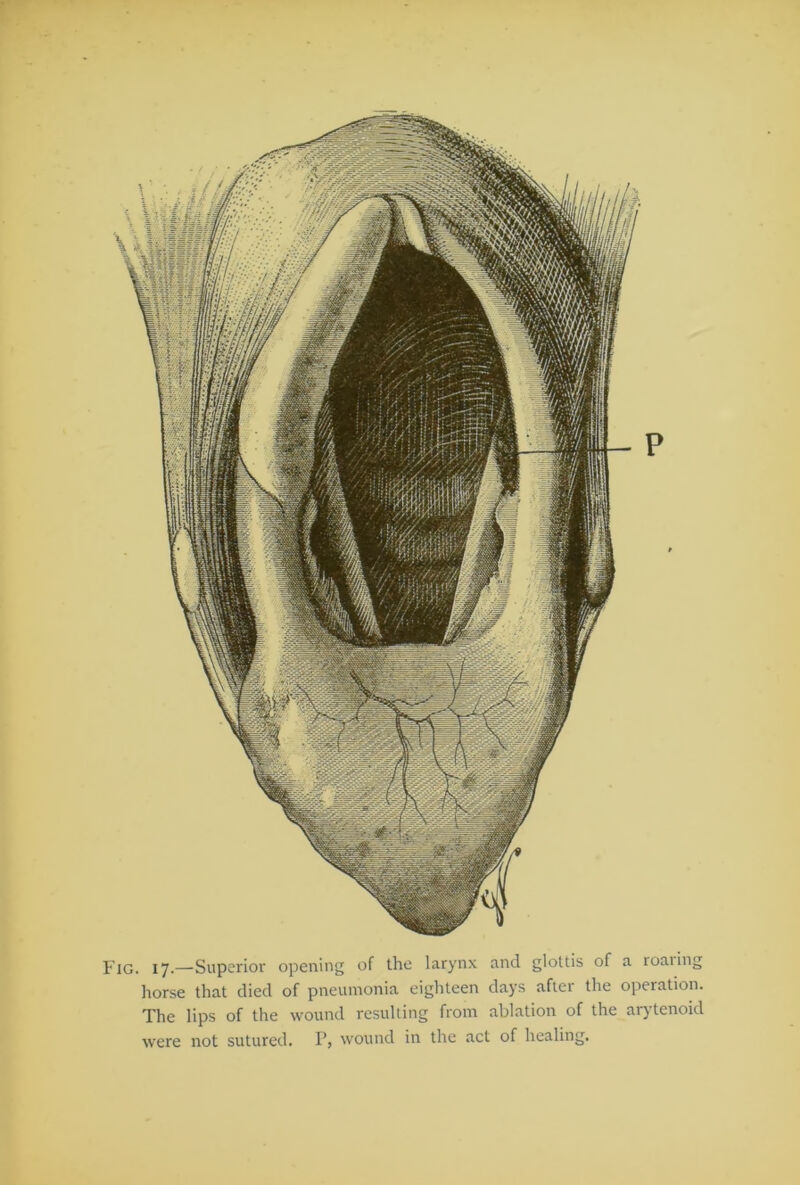 Fig. 17.—Superior opening of the larynx and glottis of a roaiing horse that died of pneumonia eighteen days after the operation. The lips of the wound resulting from ablation of the arytenoid were not sutured. P, wound in the act of healing.