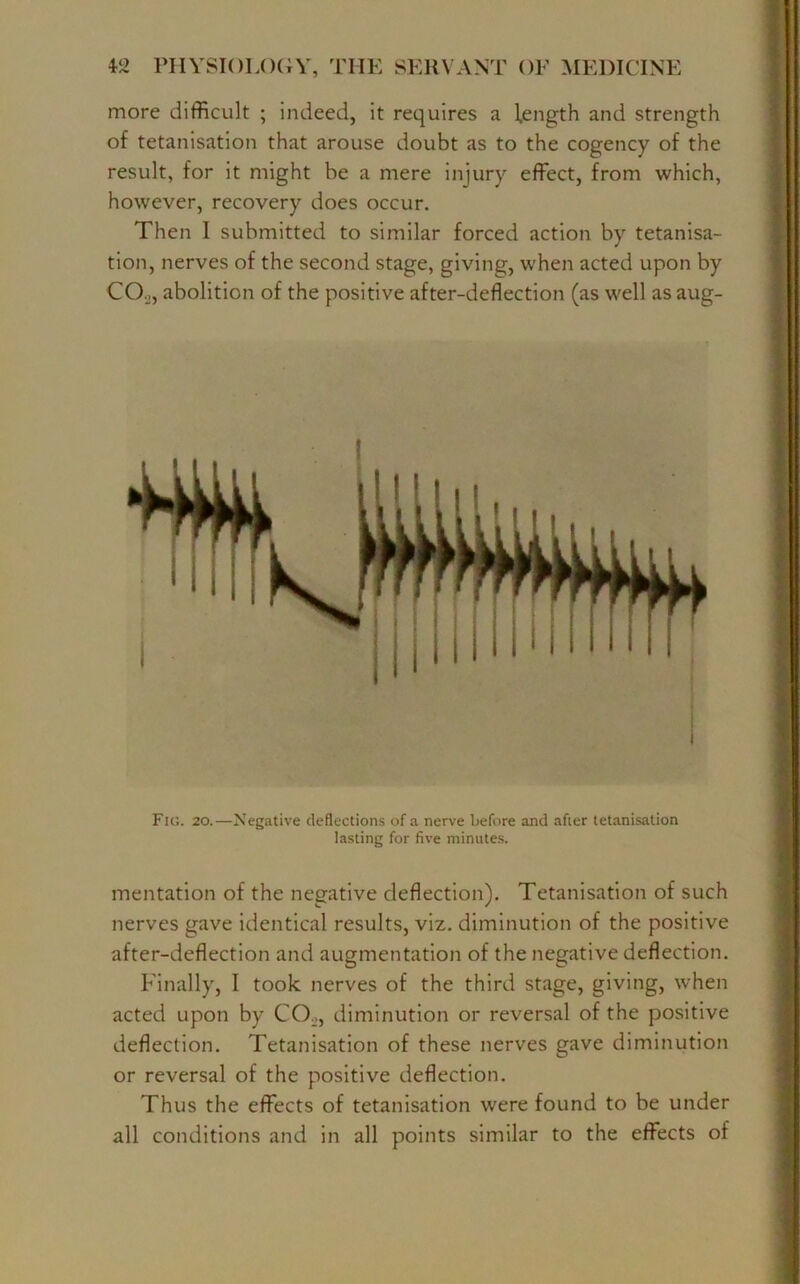 more difficult ; indeed, it requires a l.ength and strength of tetanisation that arouse doubt as to the cogency of the result, for it might be a mere injury effect, from which, however, recovery does occur. Then I submitted to similar forced action by tetanisa- tion, nerves of the second stage, giving, when acted upon by CO.,, abolition of the positive after-deflection (as well as aug- Fig. 20.—Negative deflections of a nerve before and after tetanisation lasting for five minutes. mentation of the negative deflection). Tetanisation of such nerves gave identical results, viz. diminution of the positive after-deflection and augmentation of the negative deflection. Finally, I took nerves of the third stage, giving, when acted upon by CO,, diminution or reversal of the positive deflection. Tetanisation of these nerves gave diminution or reversal of the positive deflection. Thus the effects of tetanisation were found to be under all conditions and in all points similar to the effects of